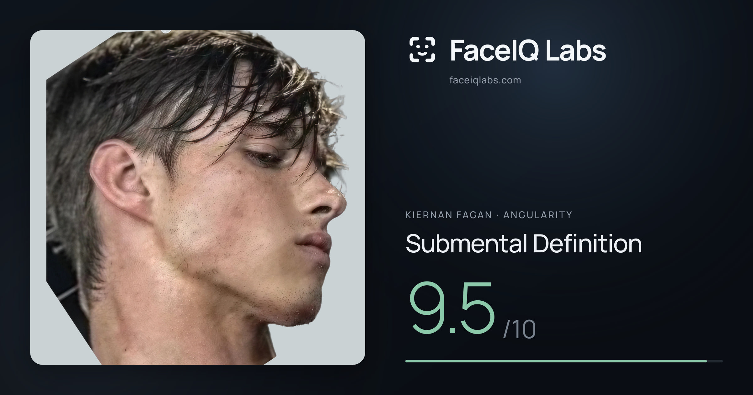 Kiernan Fagan Submental Definition: 9.5/10, drawn on the photo