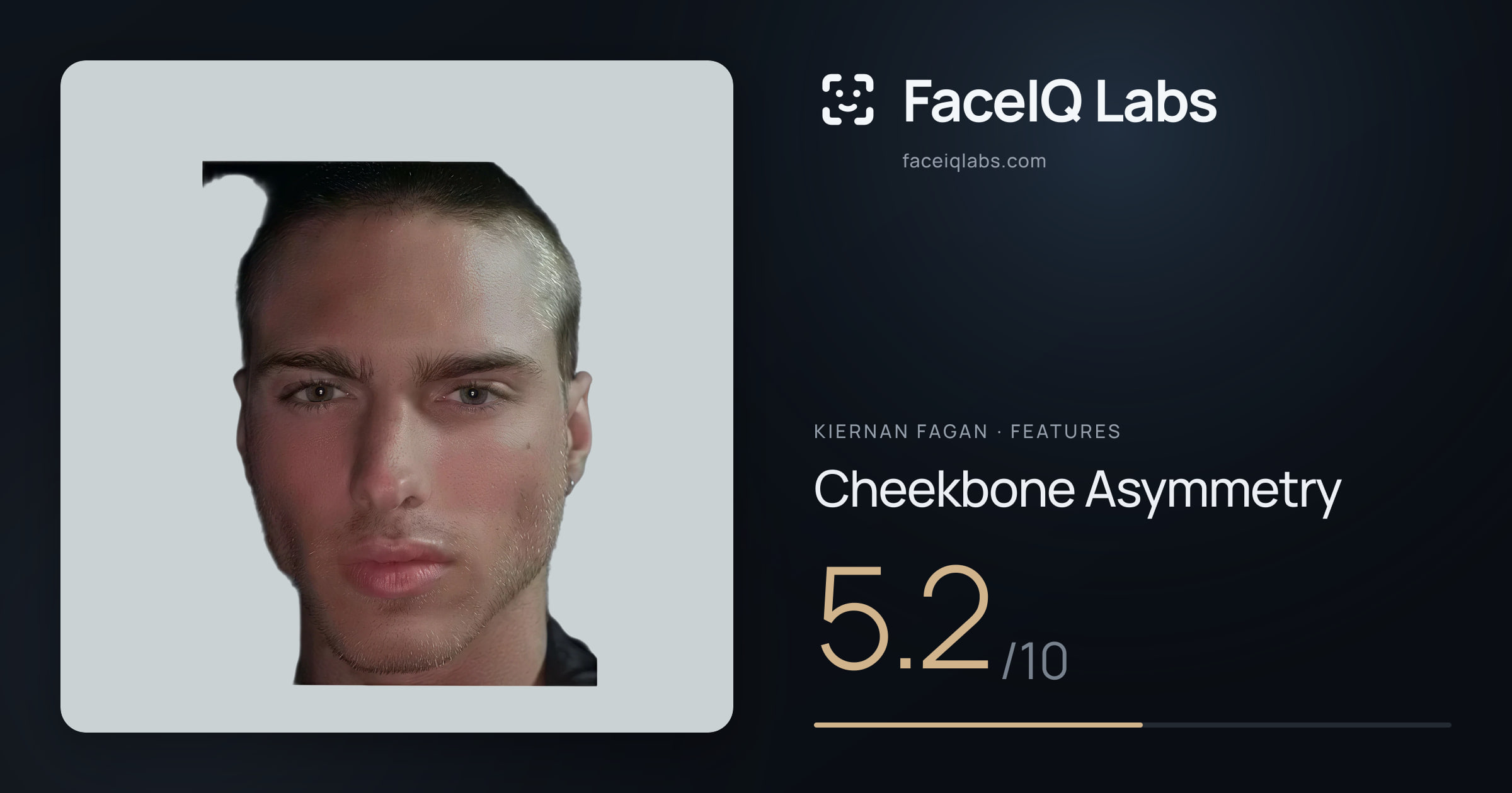 Kiernan Fagan Cheekbone Asymmetry: 5.2/10, drawn on the photo