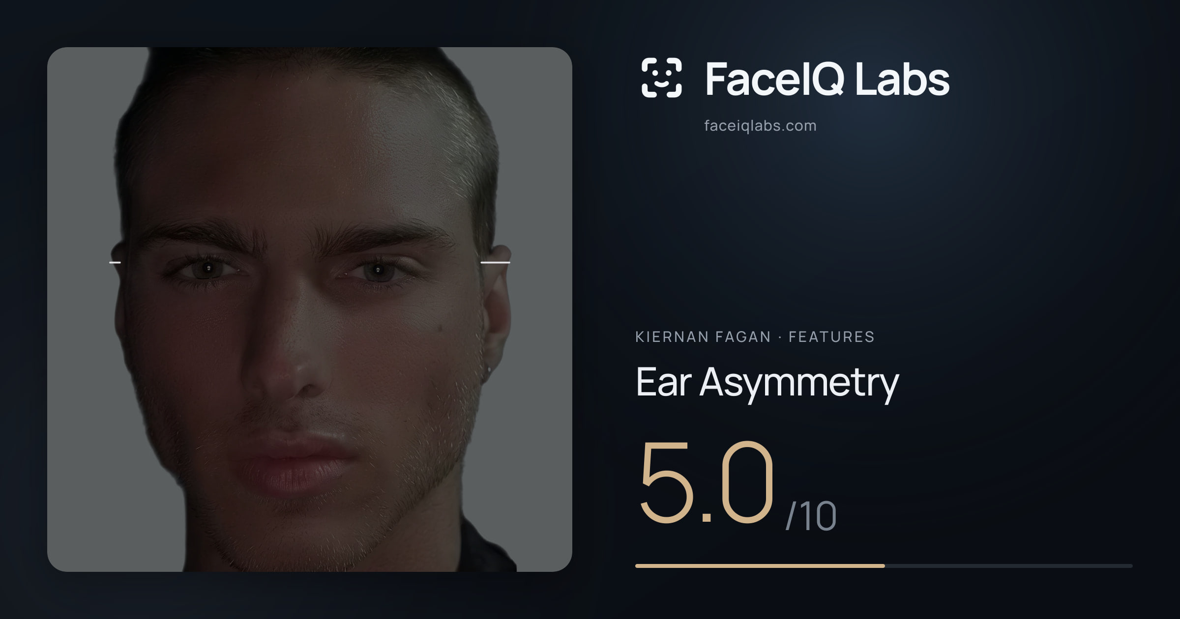 Kiernan Fagan Ear Asymmetry: 5.0/10, drawn on the photo