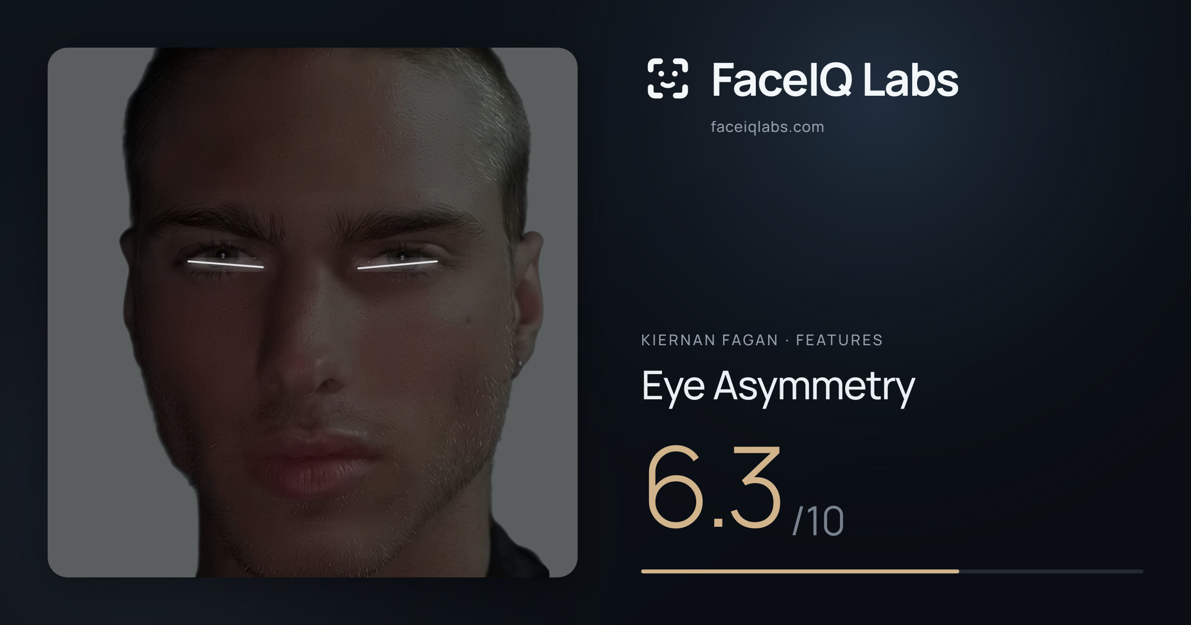 Kiernan Fagan Eye Asymmetry: 6.3/10, drawn on the photo