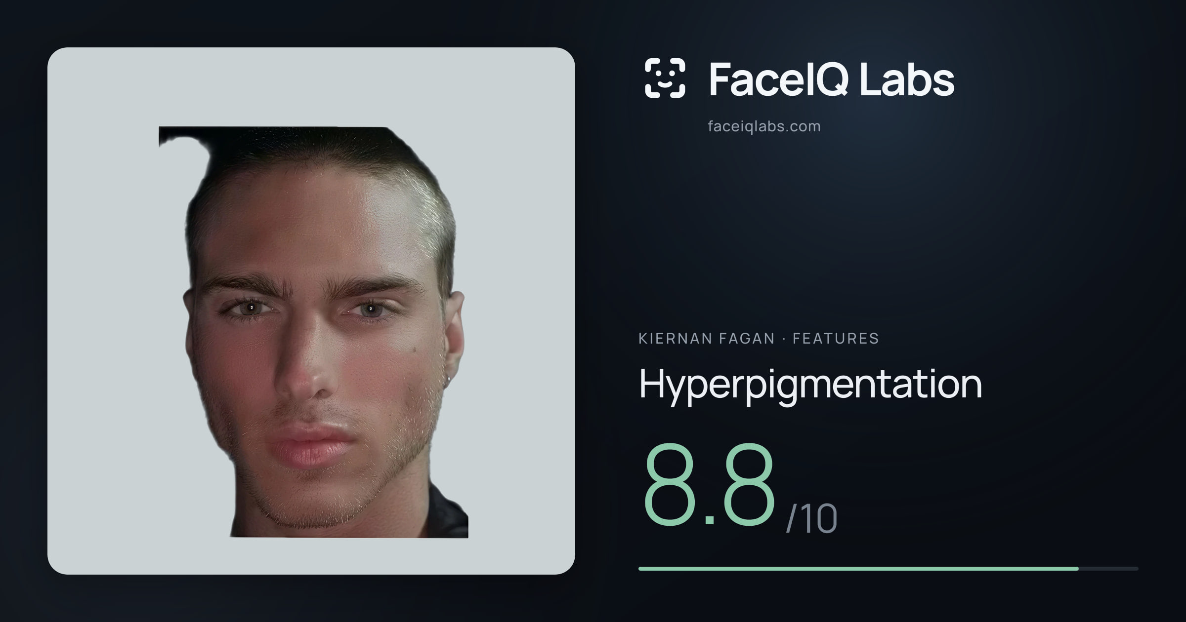 Kiernan Fagan Hyperpigmentation: 8.8/10, drawn on the photo