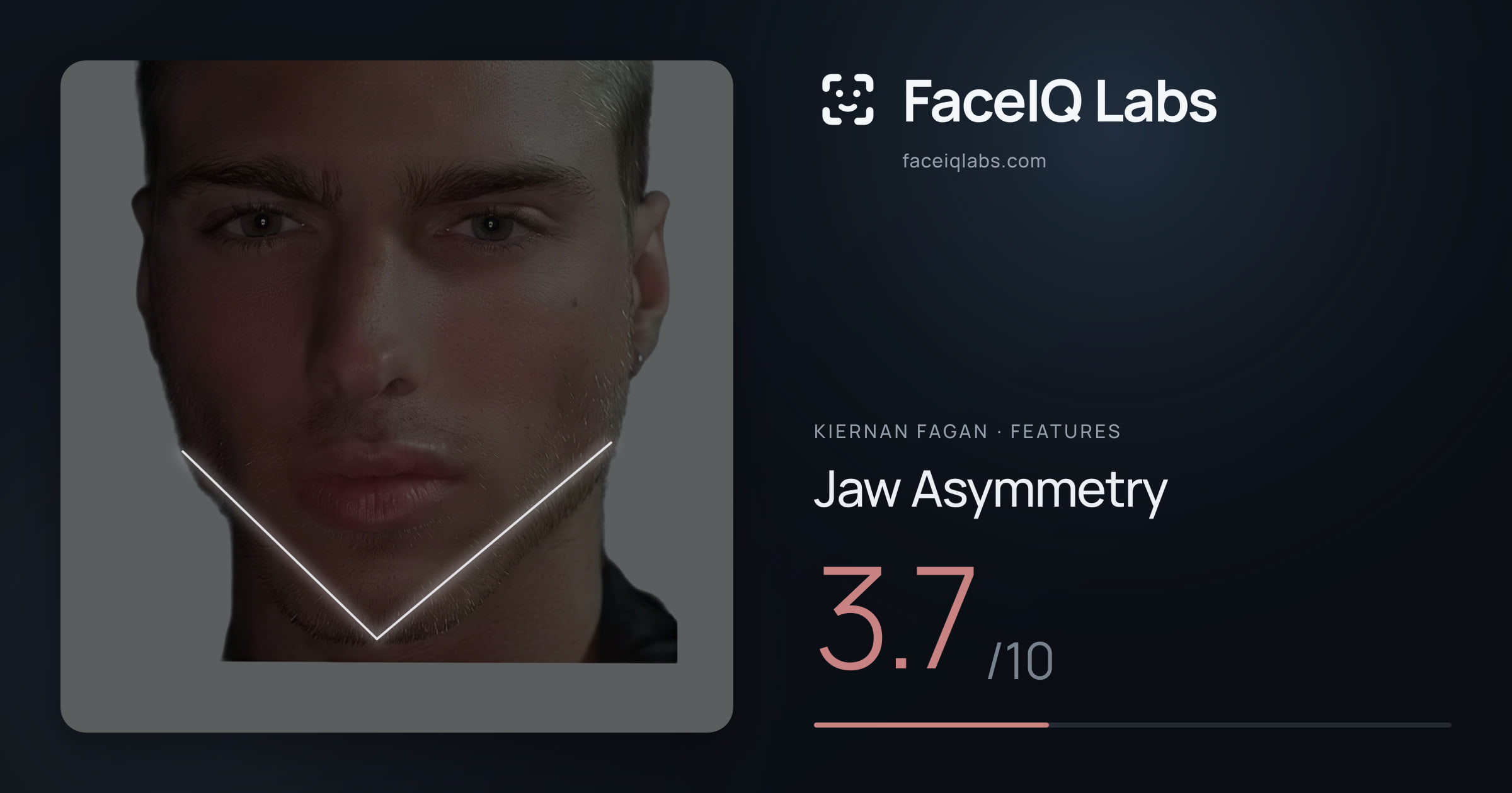 Kiernan Fagan Jaw Asymmetry: 3.7/10, drawn on the photo
