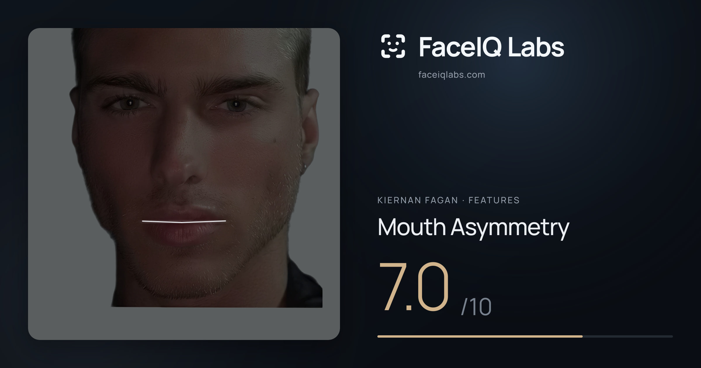 Kiernan Fagan Mouth Asymmetry: 7.0/10, drawn on the photo