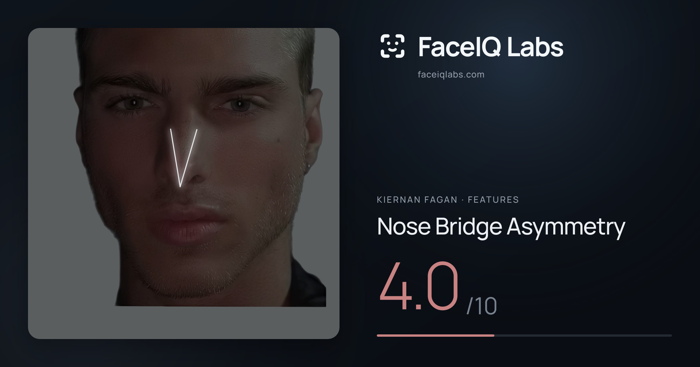 Kiernan Fagan Nose Bridge Asymmetry: 4.0/10, drawn on the photo