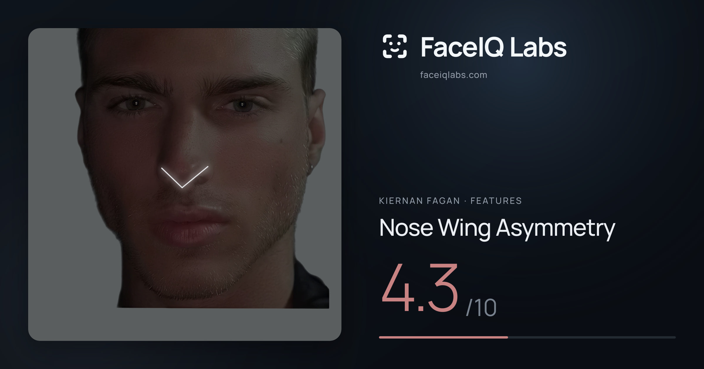 Kiernan Fagan Nose Wing Asymmetry: 4.3/10, drawn on the photo
