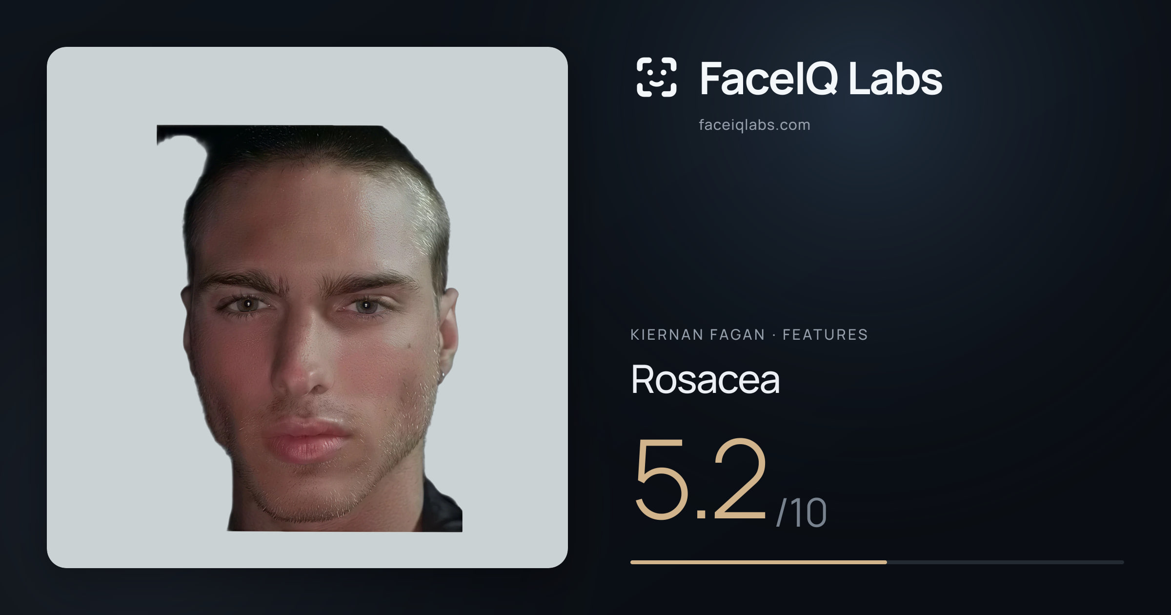Kiernan Fagan Rosacea: 5.2/10, drawn on the photo