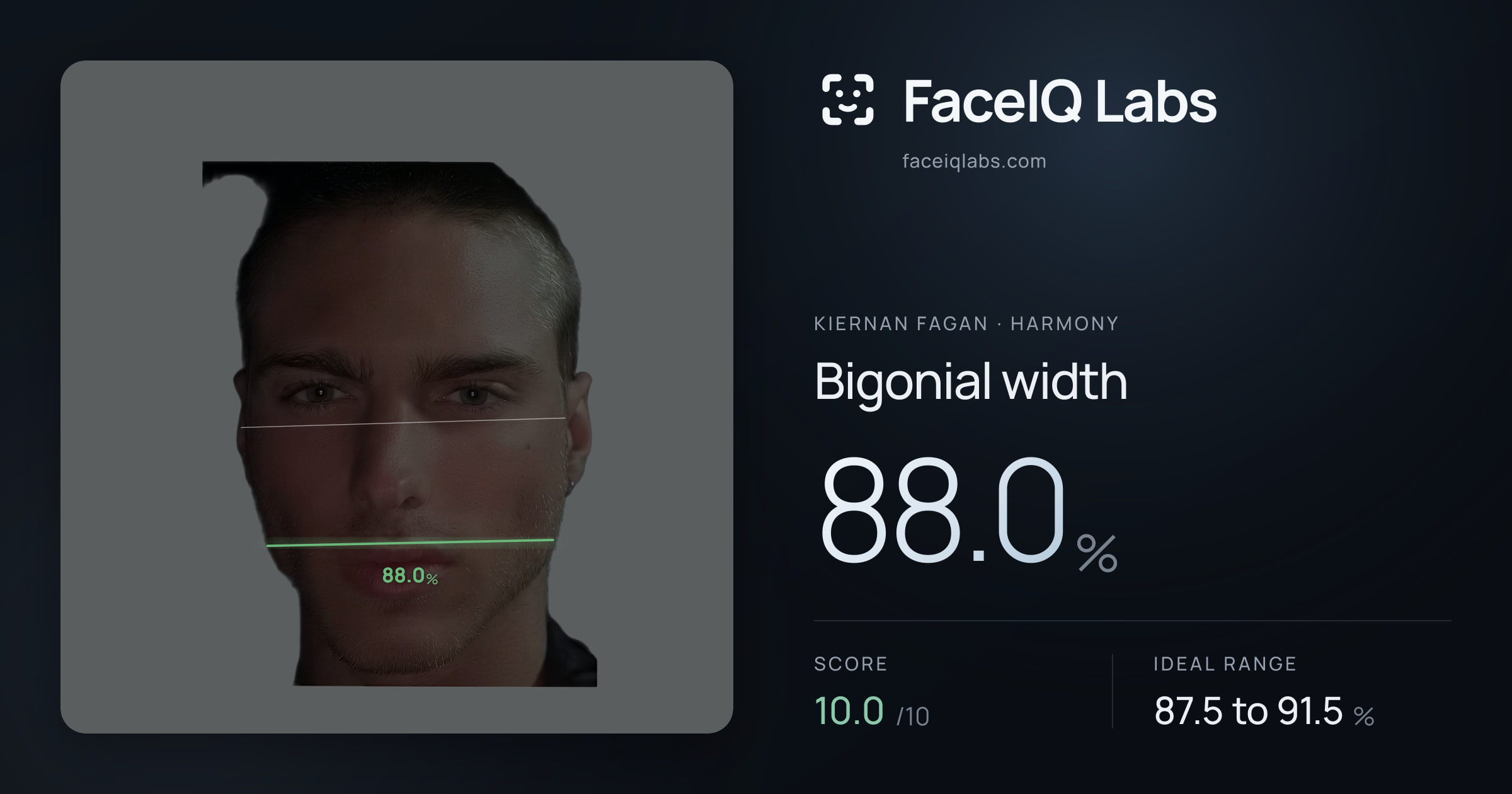 Kiernan Fagan Bigonial width: 88.0%, drawn on the photo