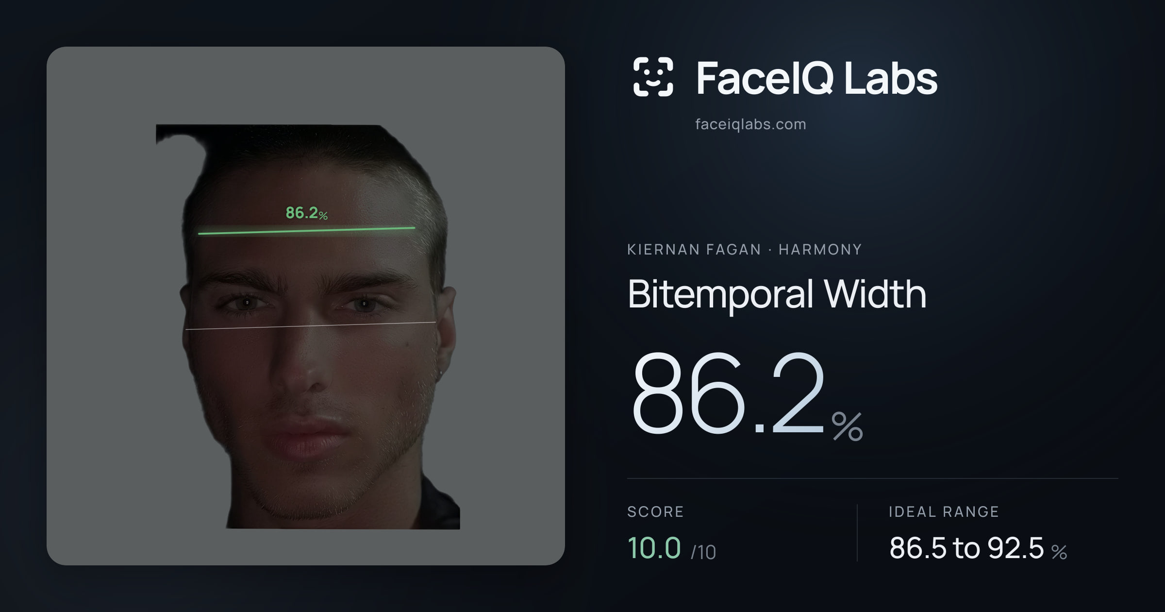 Kiernan Fagan Bitemporal Width: 86.2%, drawn on the photo