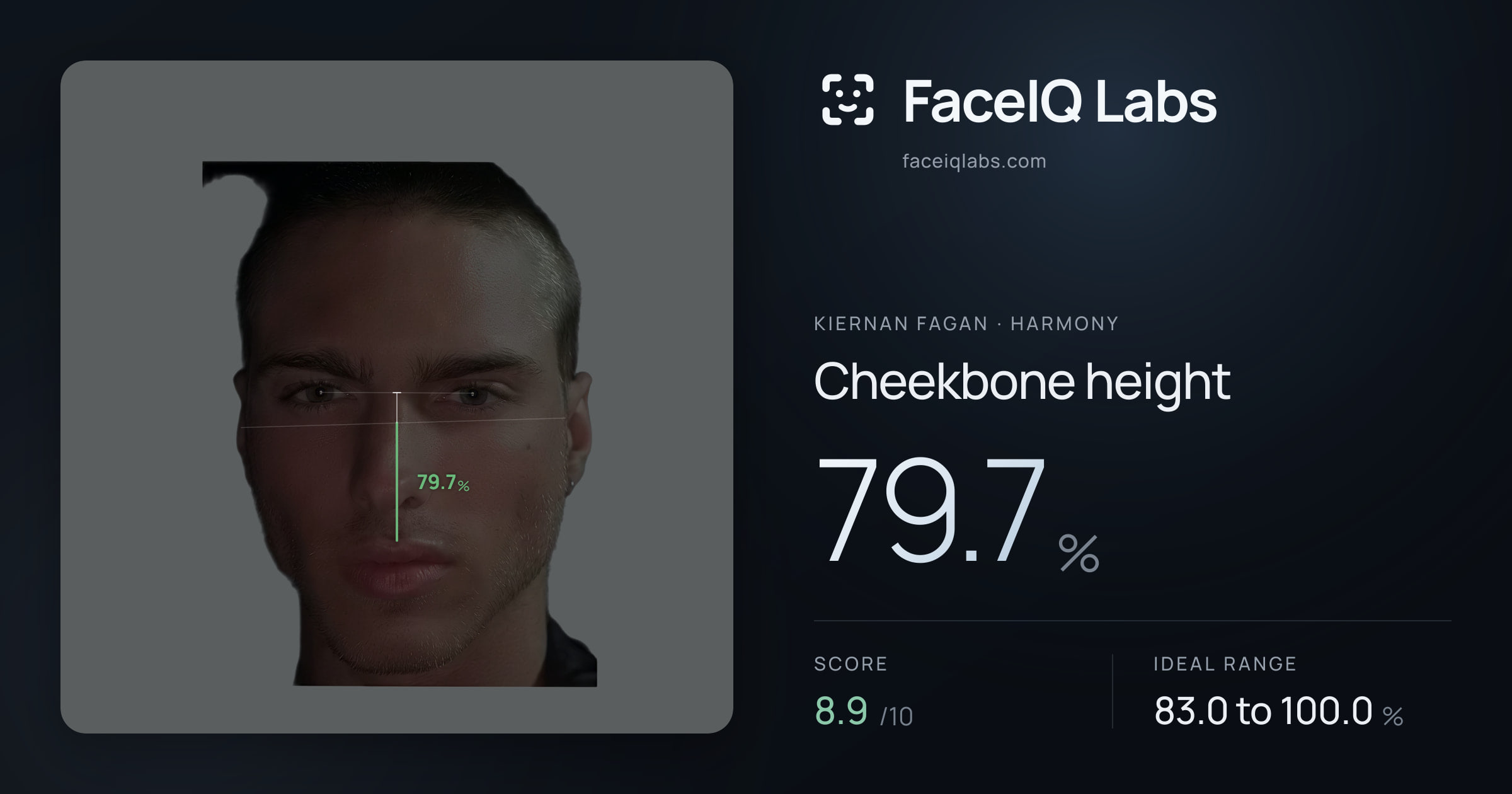 Kiernan Fagan Cheekbone height: 79.7%, drawn on the photo