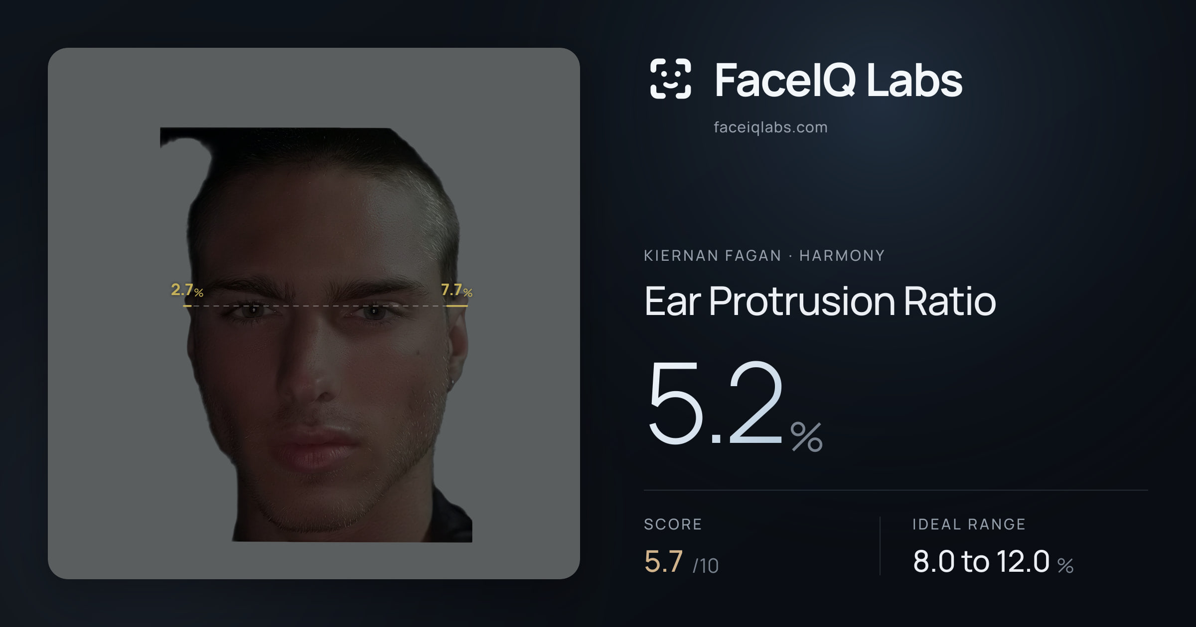 Kiernan Fagan Ear Protrusion Ratio: 5.2%, drawn on the photo