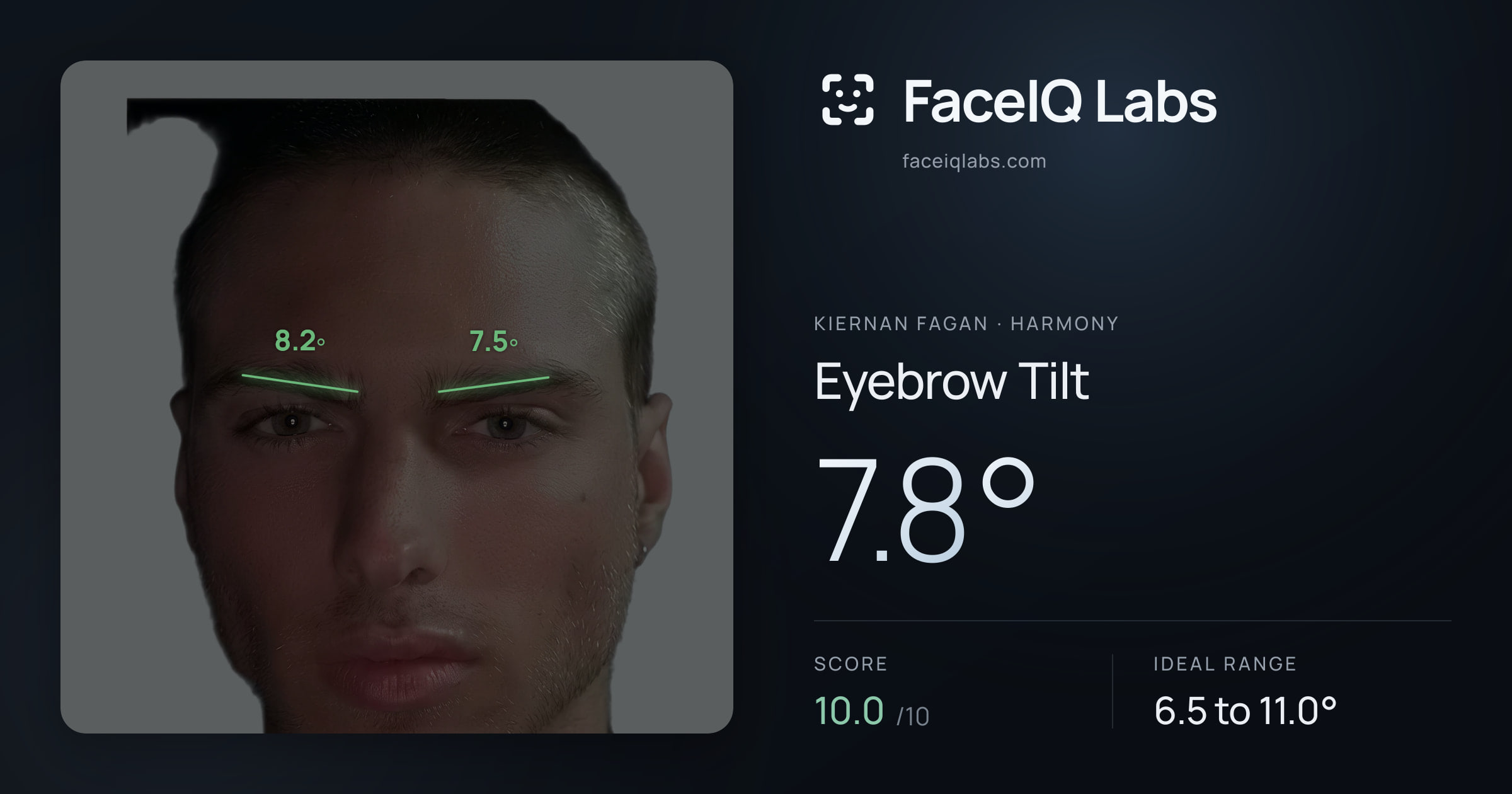 Kiernan Fagan Eyebrow Tilt: 7.8°, drawn on the photo