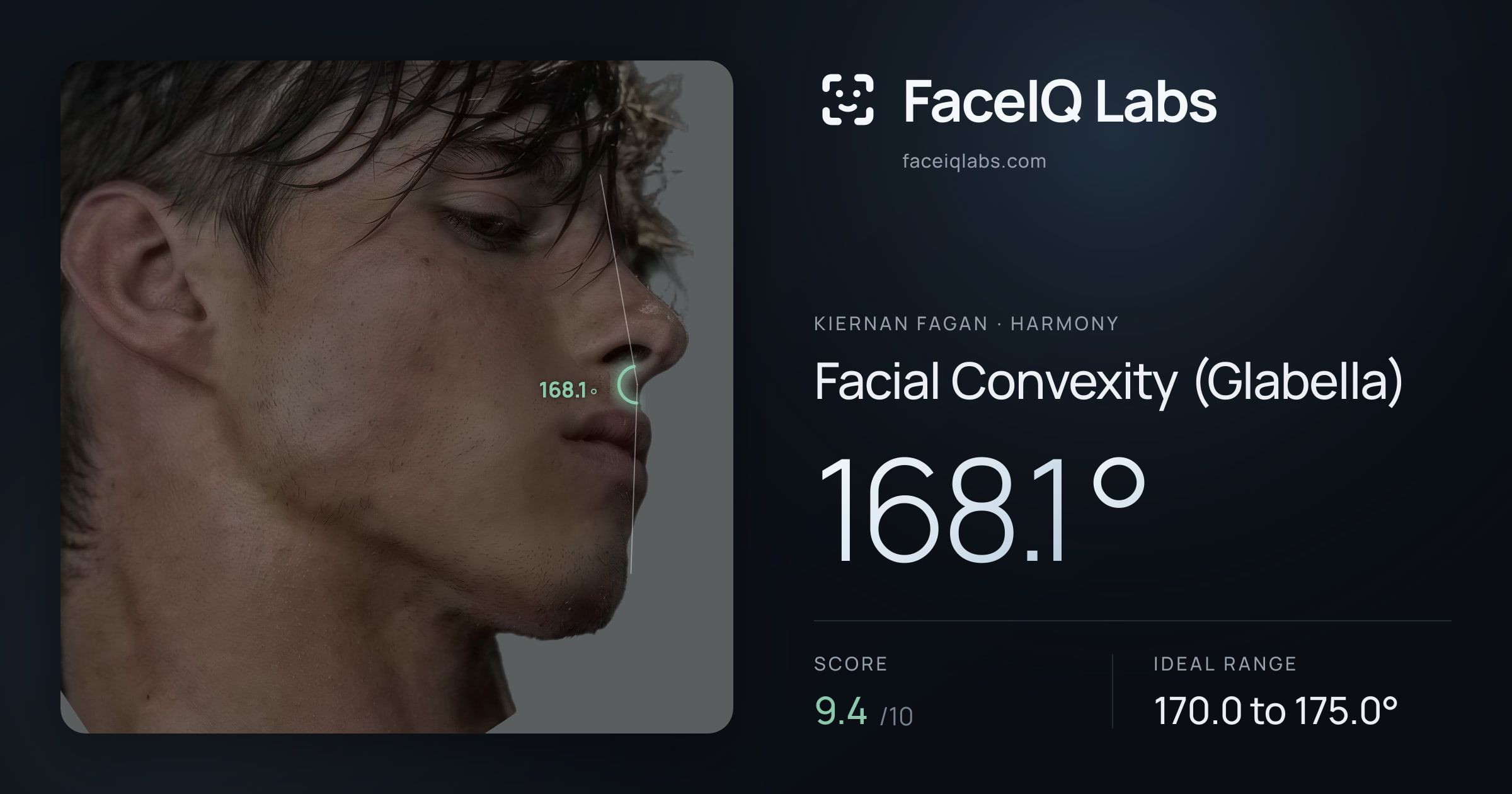 Kiernan Fagan Facial Convexity (Glabella): 168.1°, drawn on the photo