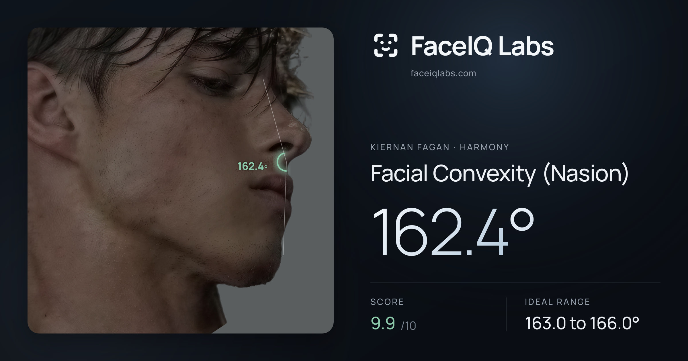 Kiernan Fagan Facial Convexity (Nasion): 162.4°, drawn on the photo