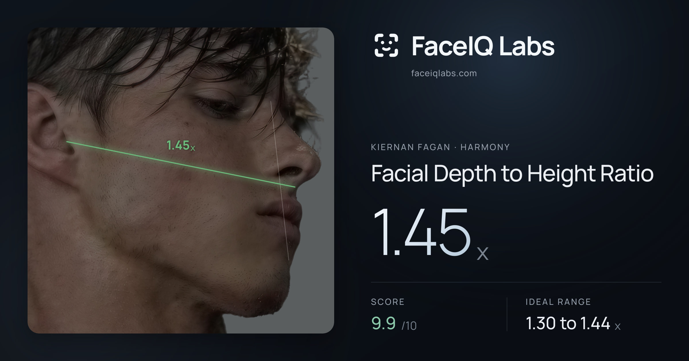 Kiernan Fagan Facial Depth to Height Ratio: 1.45x, drawn on the photo