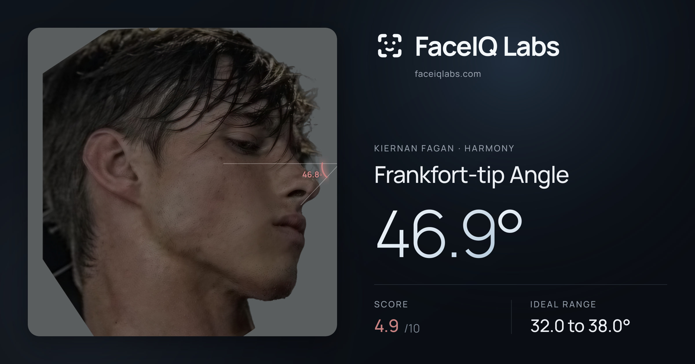 Kiernan Fagan Frankfort-tip Angle: 46.9°, drawn on the photo