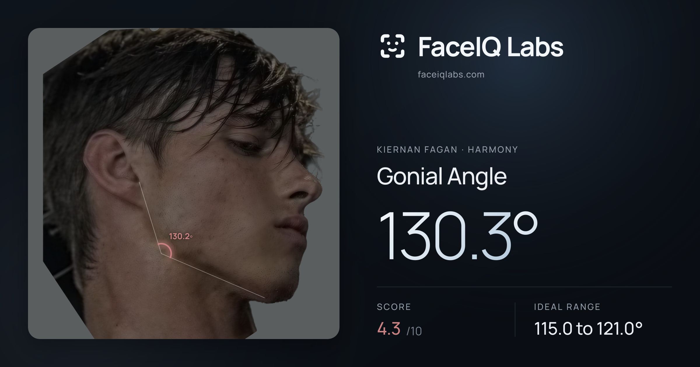 Kiernan Fagan Gonial Angle: 130.3°, drawn on the photo