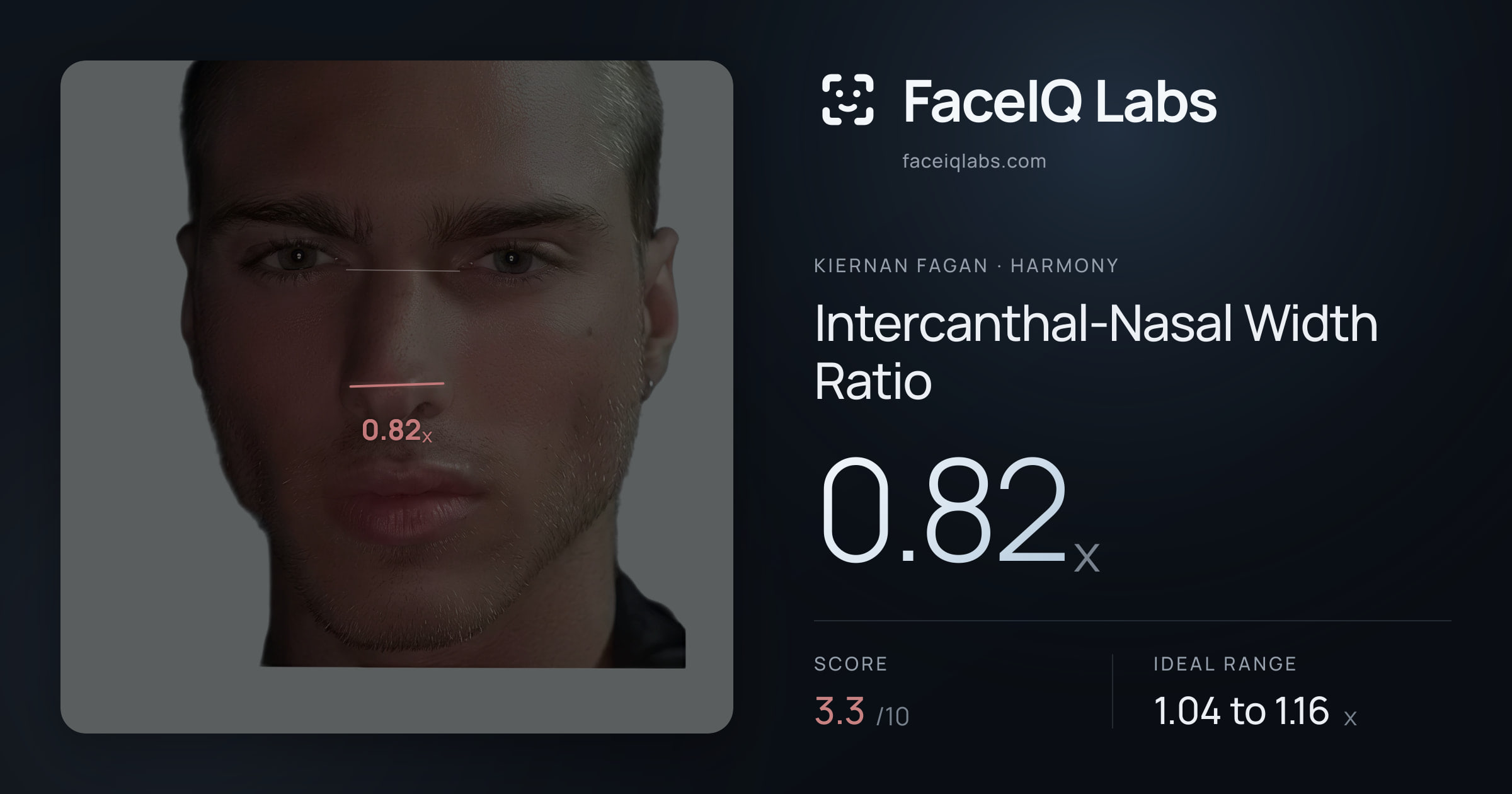 Kiernan Fagan Intercanthal-Nasal Width Ratio: 0.82x, drawn on the photo
