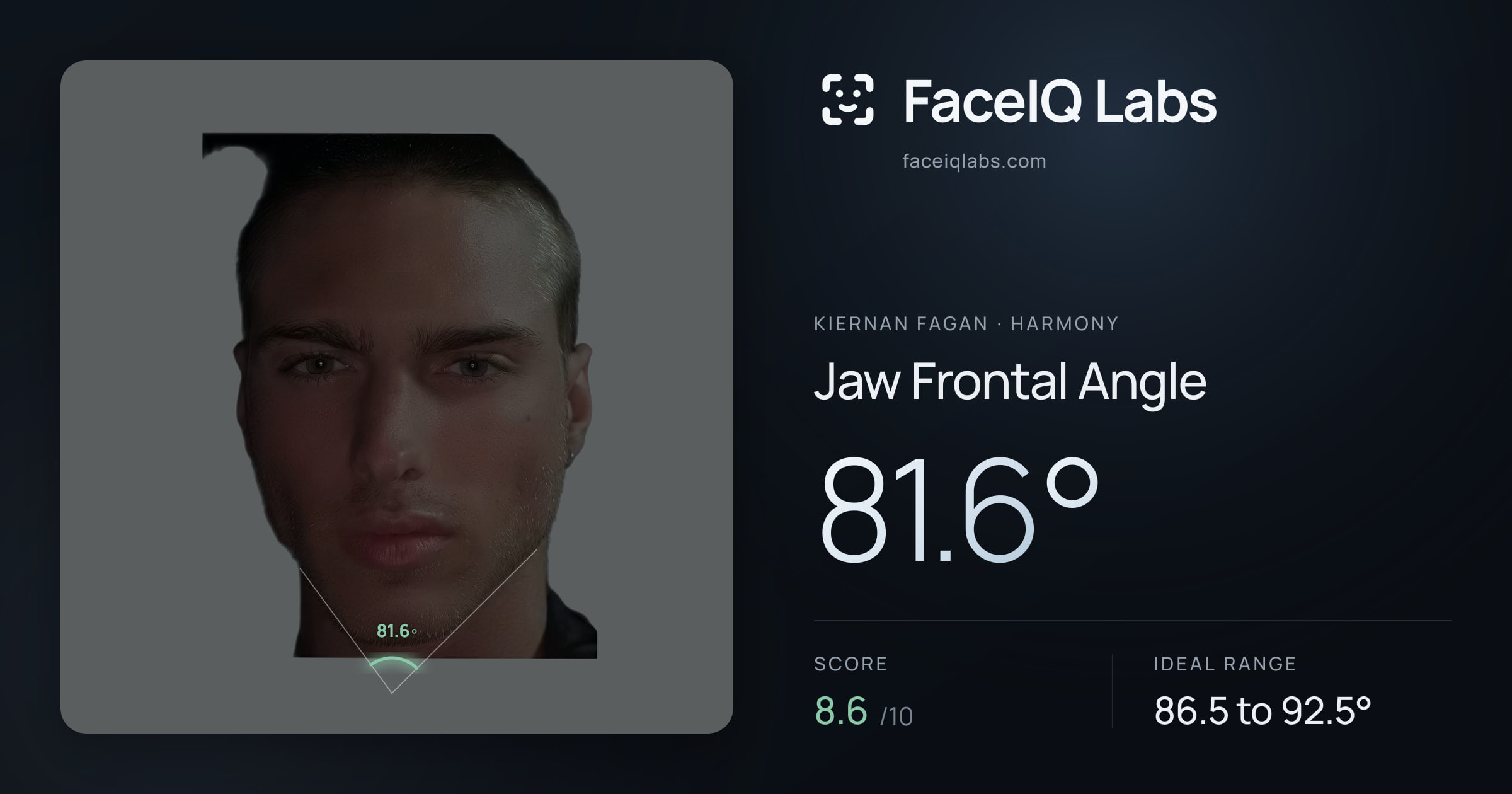 Kiernan Fagan Jaw Frontal Angle: 81.6°, drawn on the photo