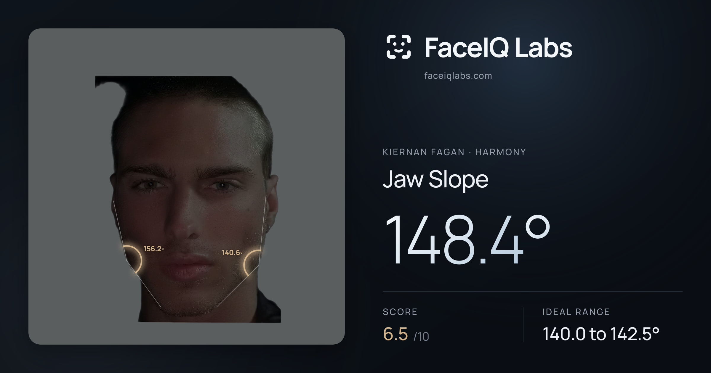Kiernan Fagan Jaw Slope: 148.4°, drawn on the photo
