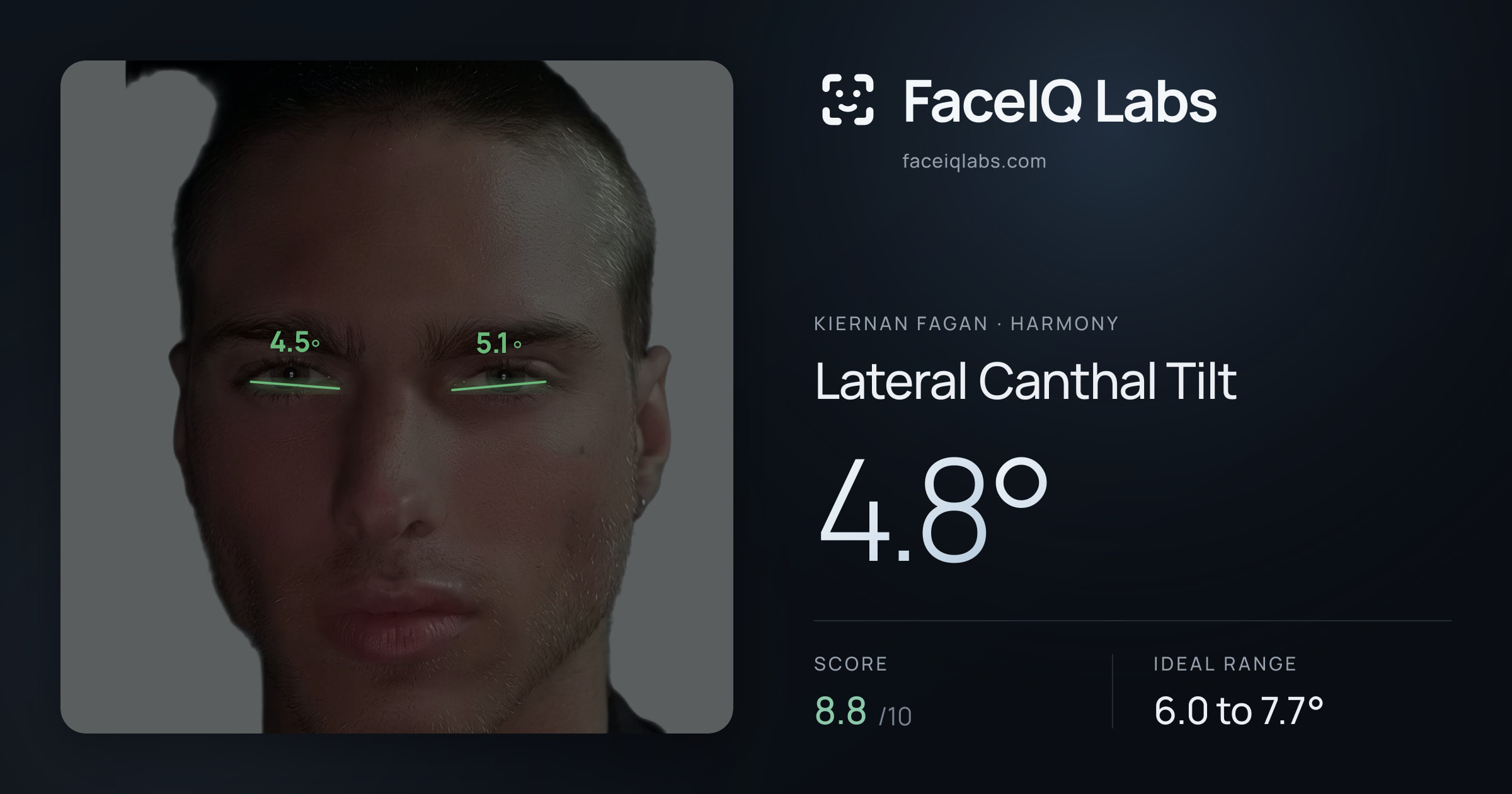 Kiernan Fagan Lateral Canthal Tilt: 4.8°, drawn on the photo