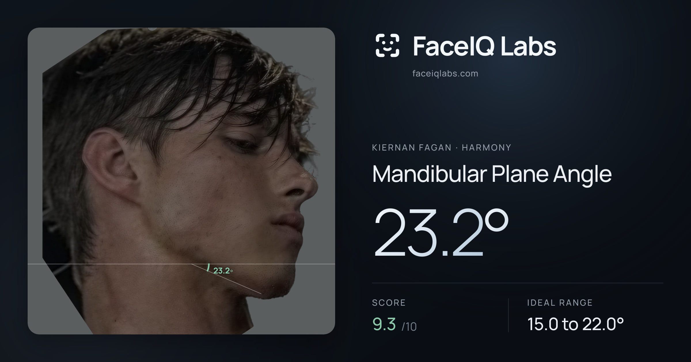 Kiernan Fagan Mandibular Plane Angle: 23.2°, drawn on the photo