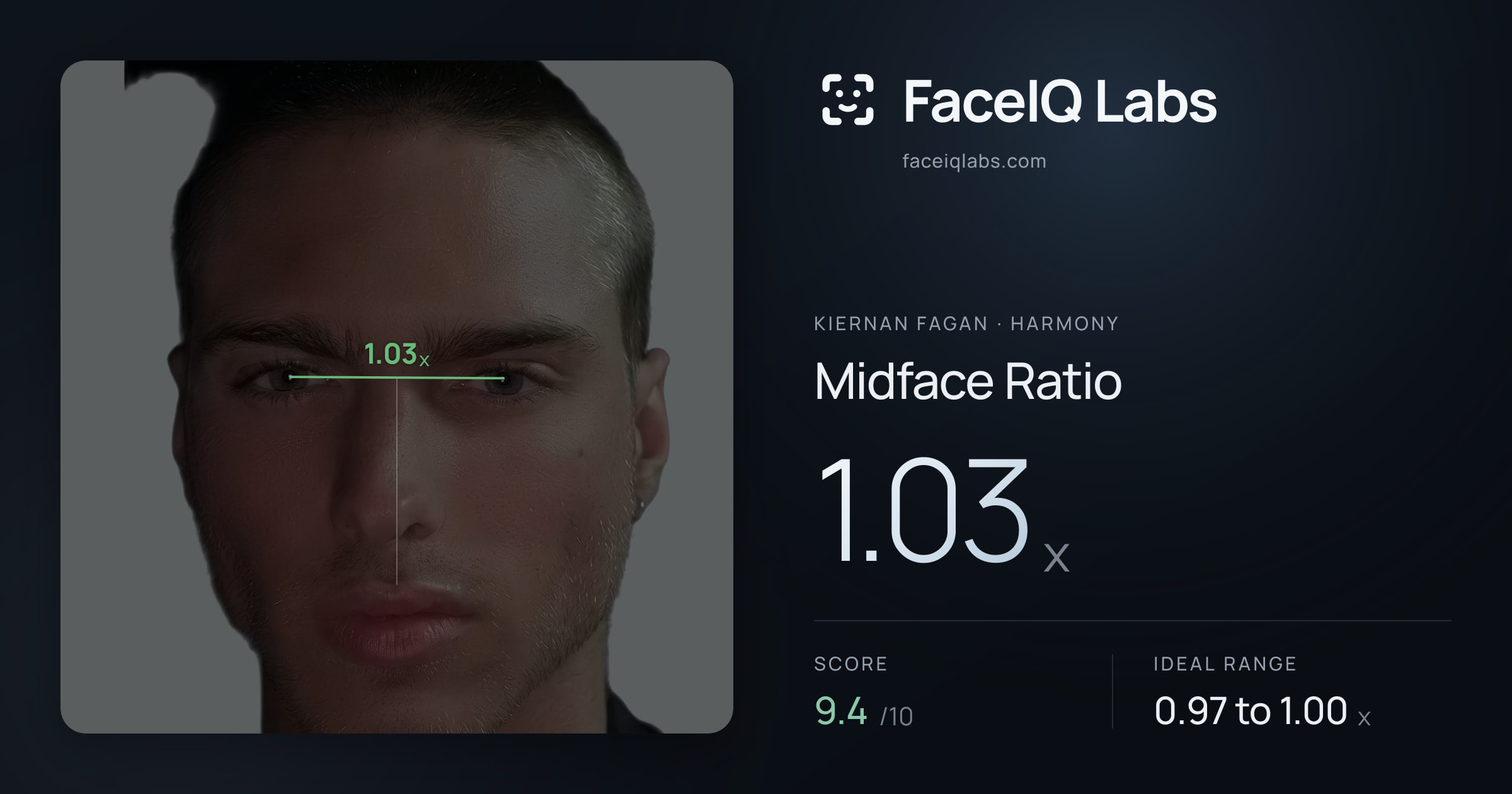 Kiernan Fagan Midface Ratio: 1.03x, drawn on the photo
