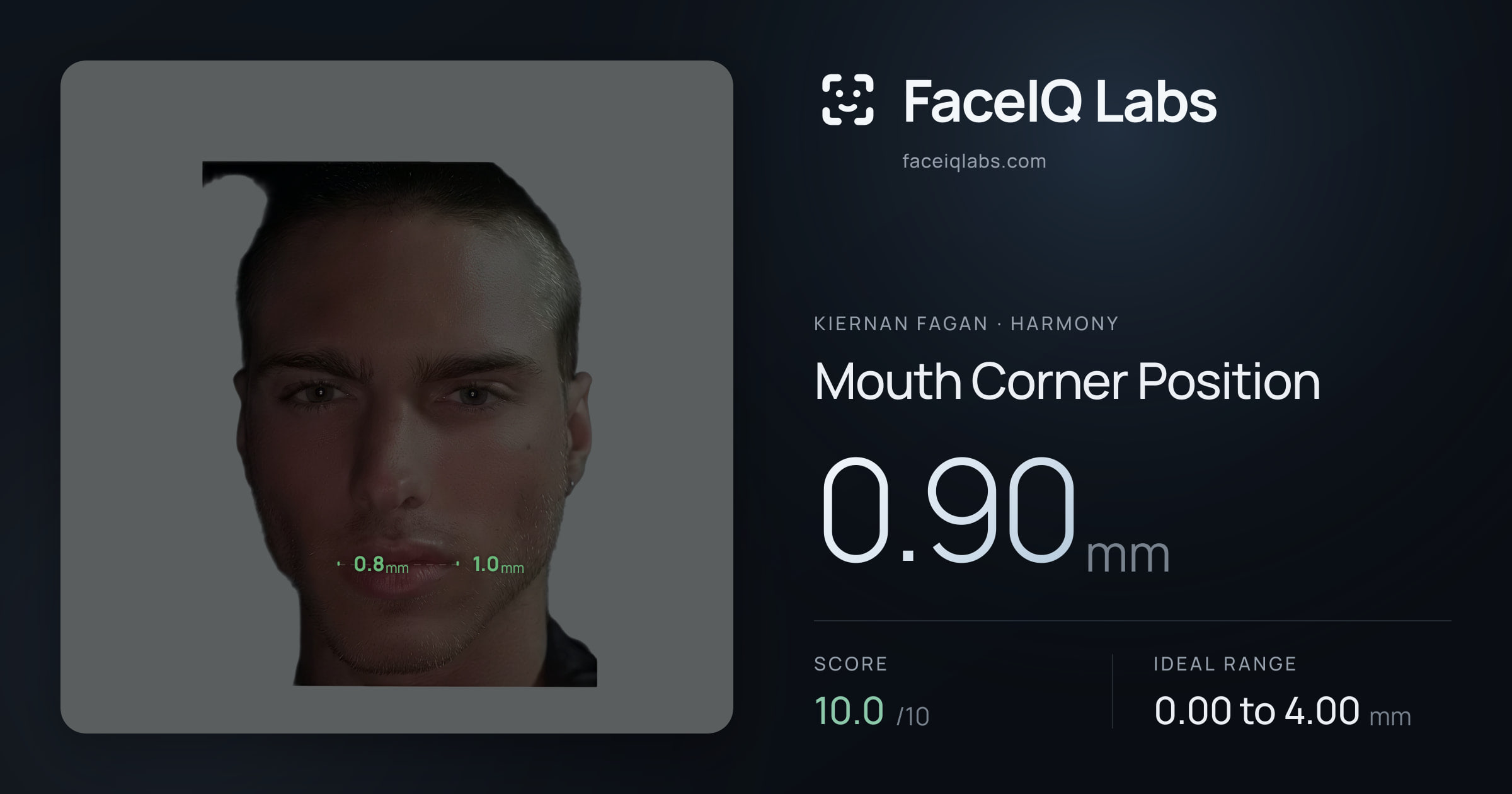 Kiernan Fagan Mouth Corner Position: 0.90mm, drawn on the photo