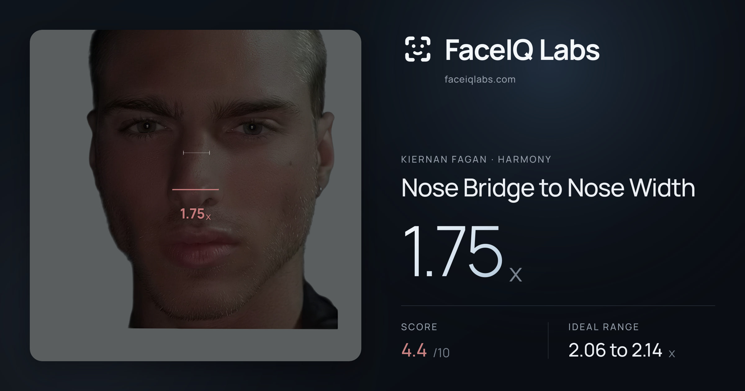 Kiernan Fagan Nose Bridge to Nose Width: 1.75x, drawn on the photo
