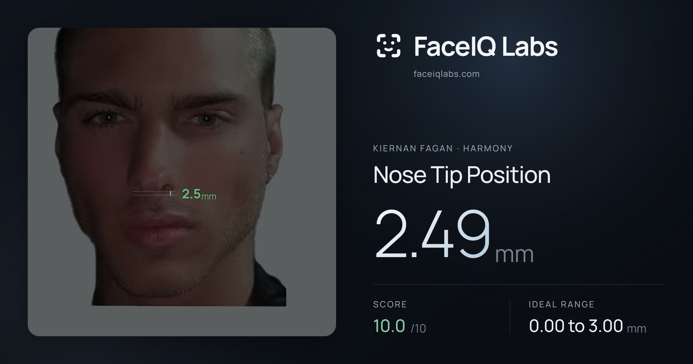 Kiernan Fagan Nose Tip Position: 2.49mm, drawn on the photo