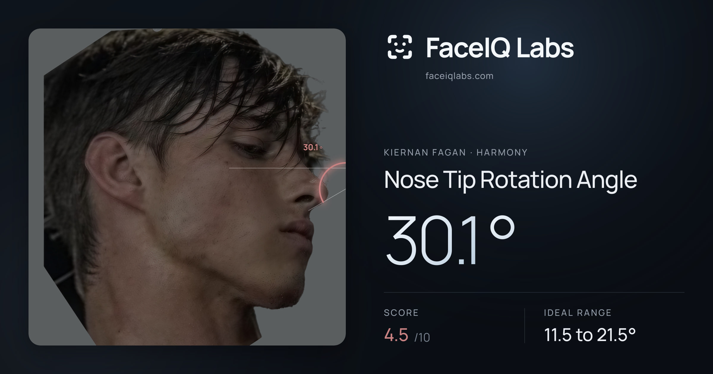 Kiernan Fagan Nose Tip Rotation Angle: 30.1°, drawn on the photo