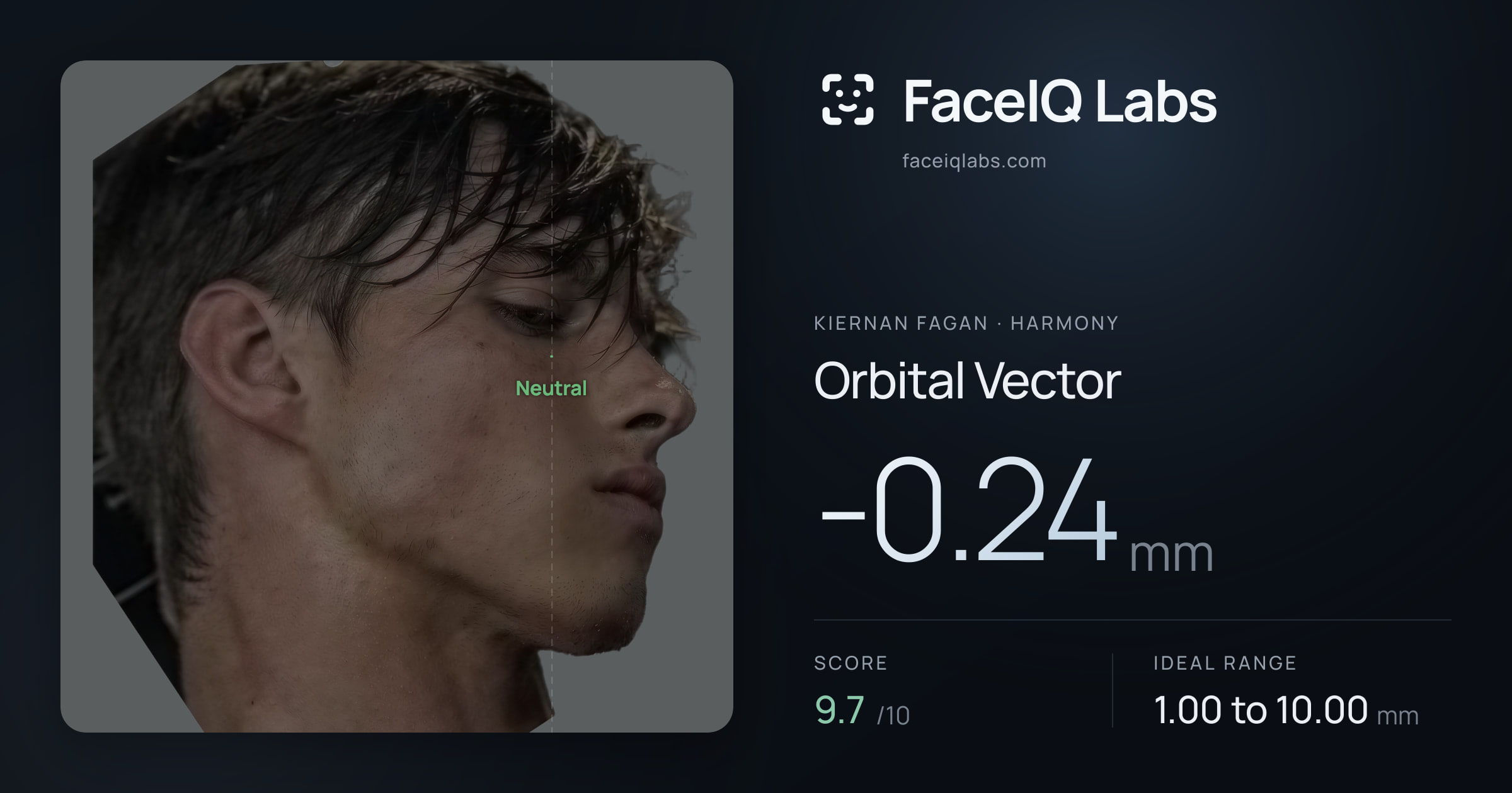 Kiernan Fagan Orbital Vector: -0.24mm, drawn on the photo