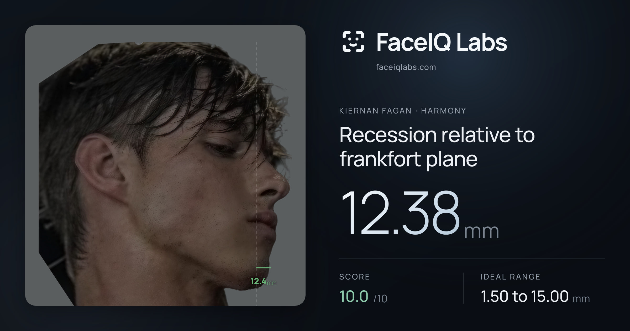 Kiernan Fagan Recession relative to frankfort plane: 12.38mm, drawn on the photo