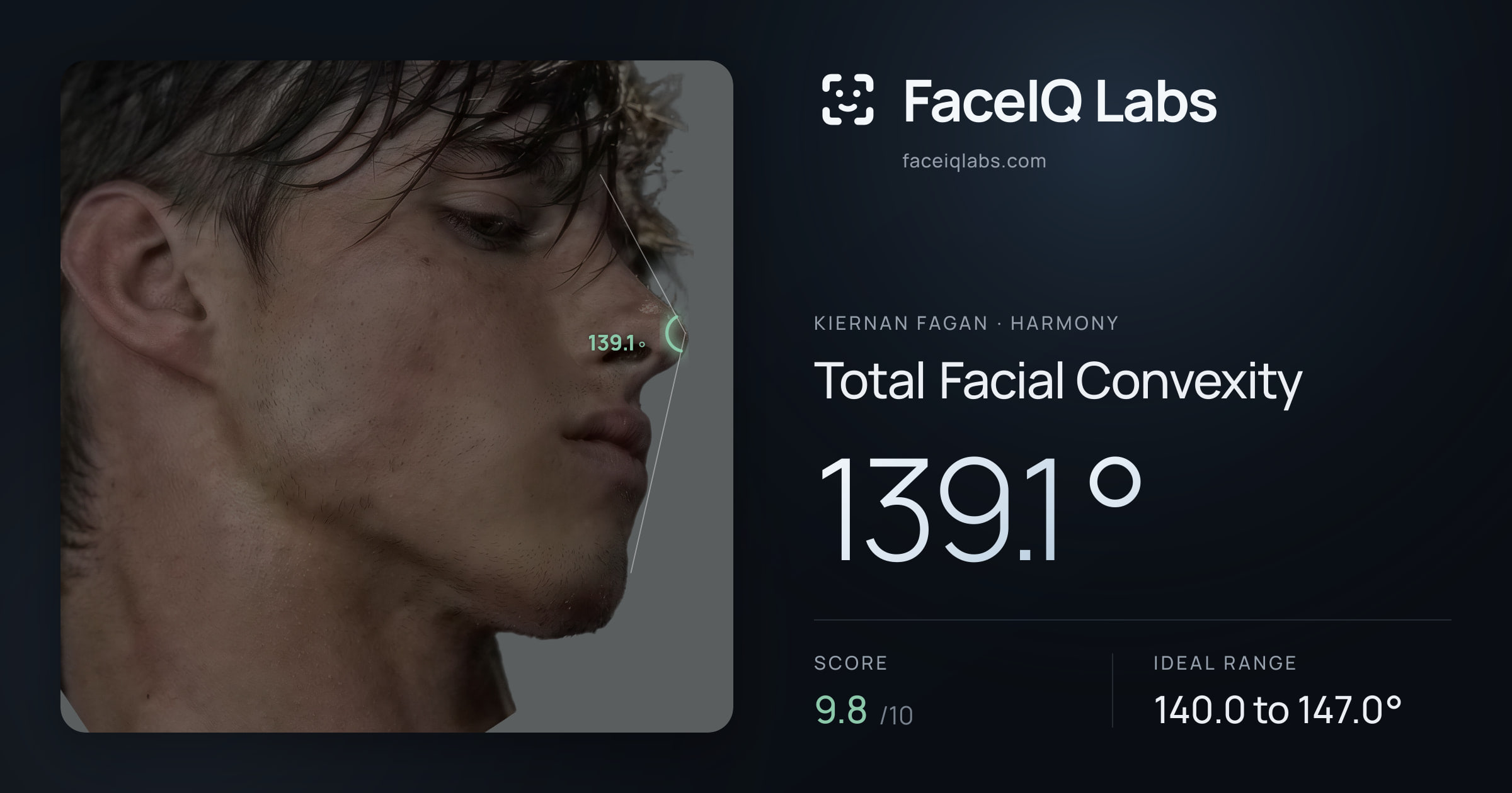 Kiernan Fagan Total Facial Convexity: 139.1°, drawn on the photo