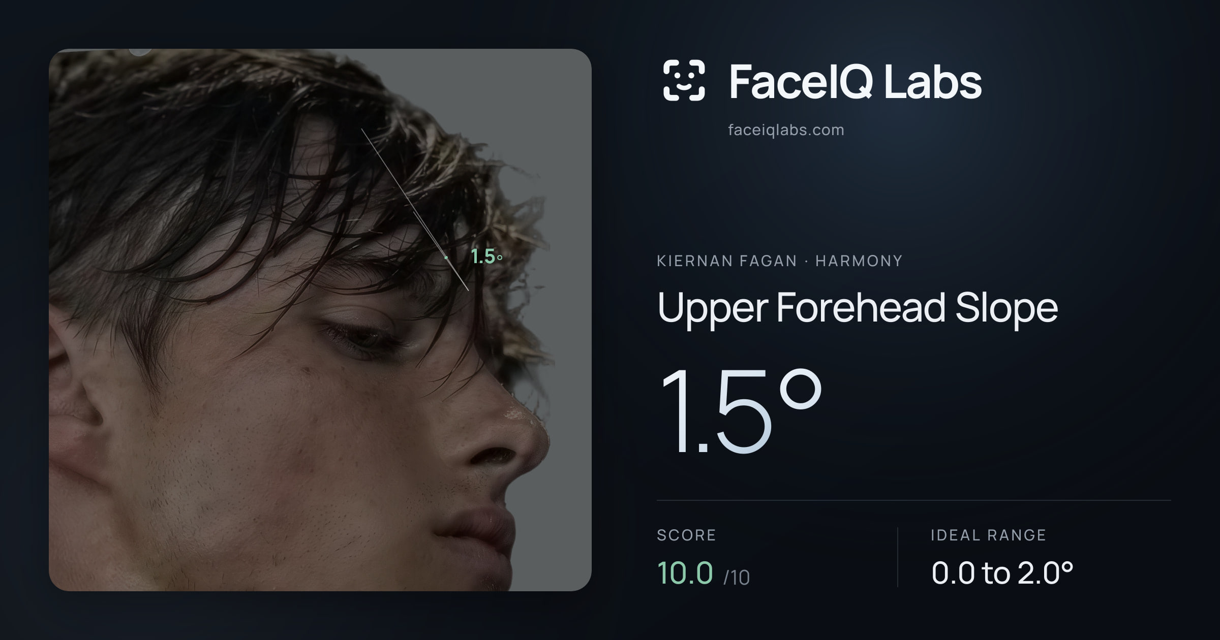 Kiernan Fagan Upper Forehead Slope: 1.5°, drawn on the photo