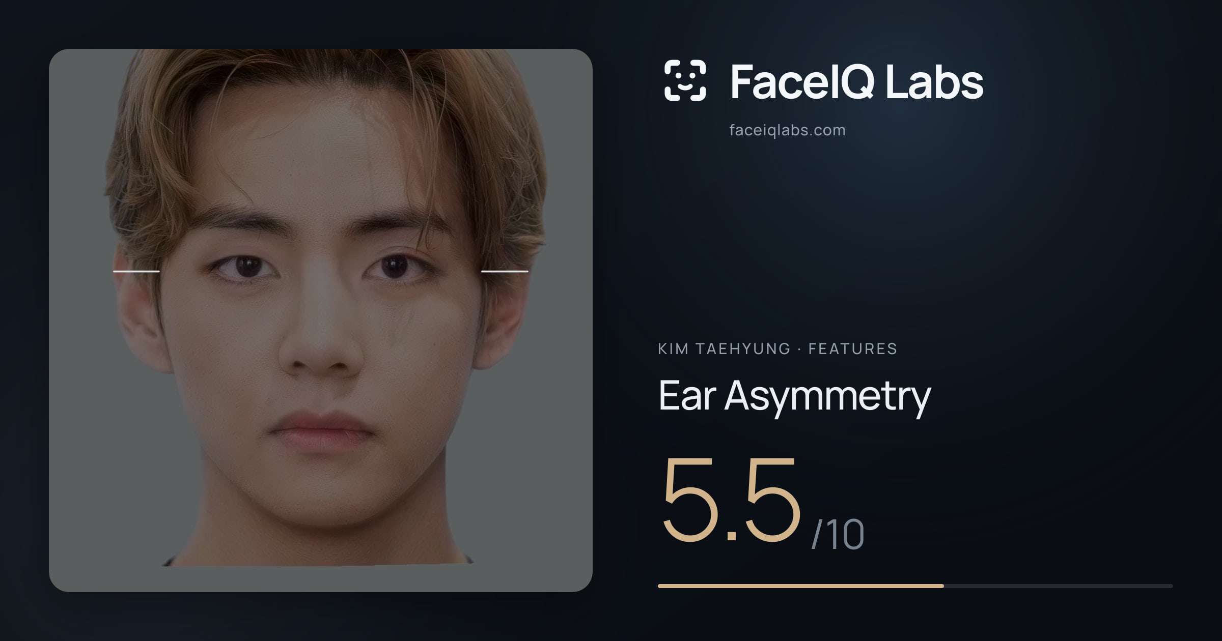 Kim Taehyung Ear Asymmetry: 5.5/10, drawn on the photo