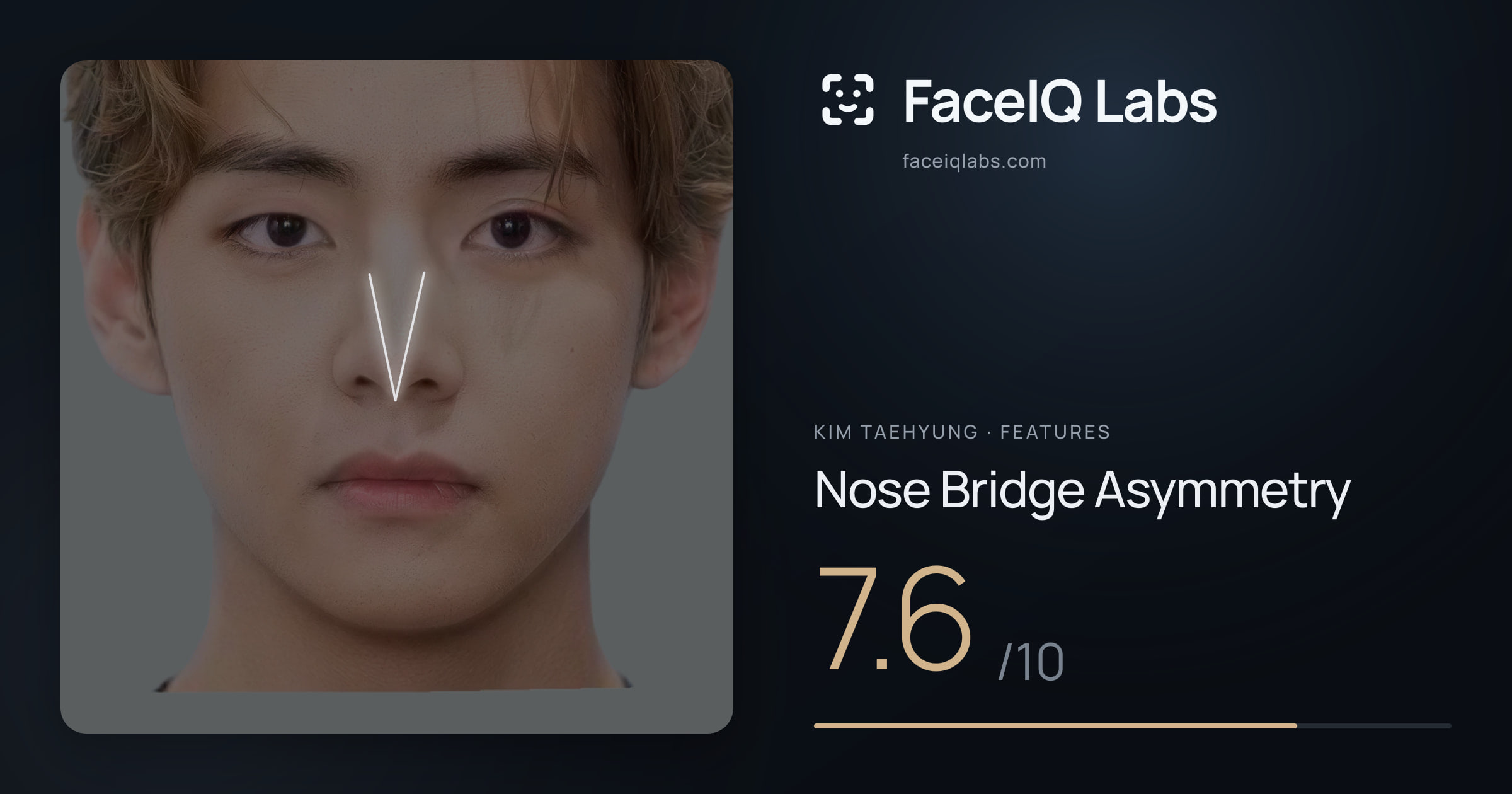 Kim Taehyung Nose Bridge Asymmetry: 7.6/10, drawn on the photo
