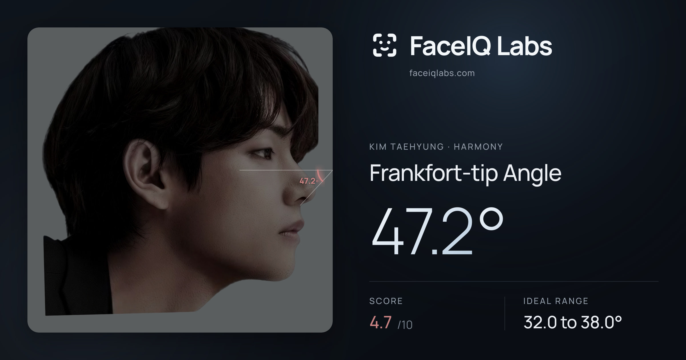 Kim Taehyung Frankfort-tip Angle: 47.2°, drawn on the photo