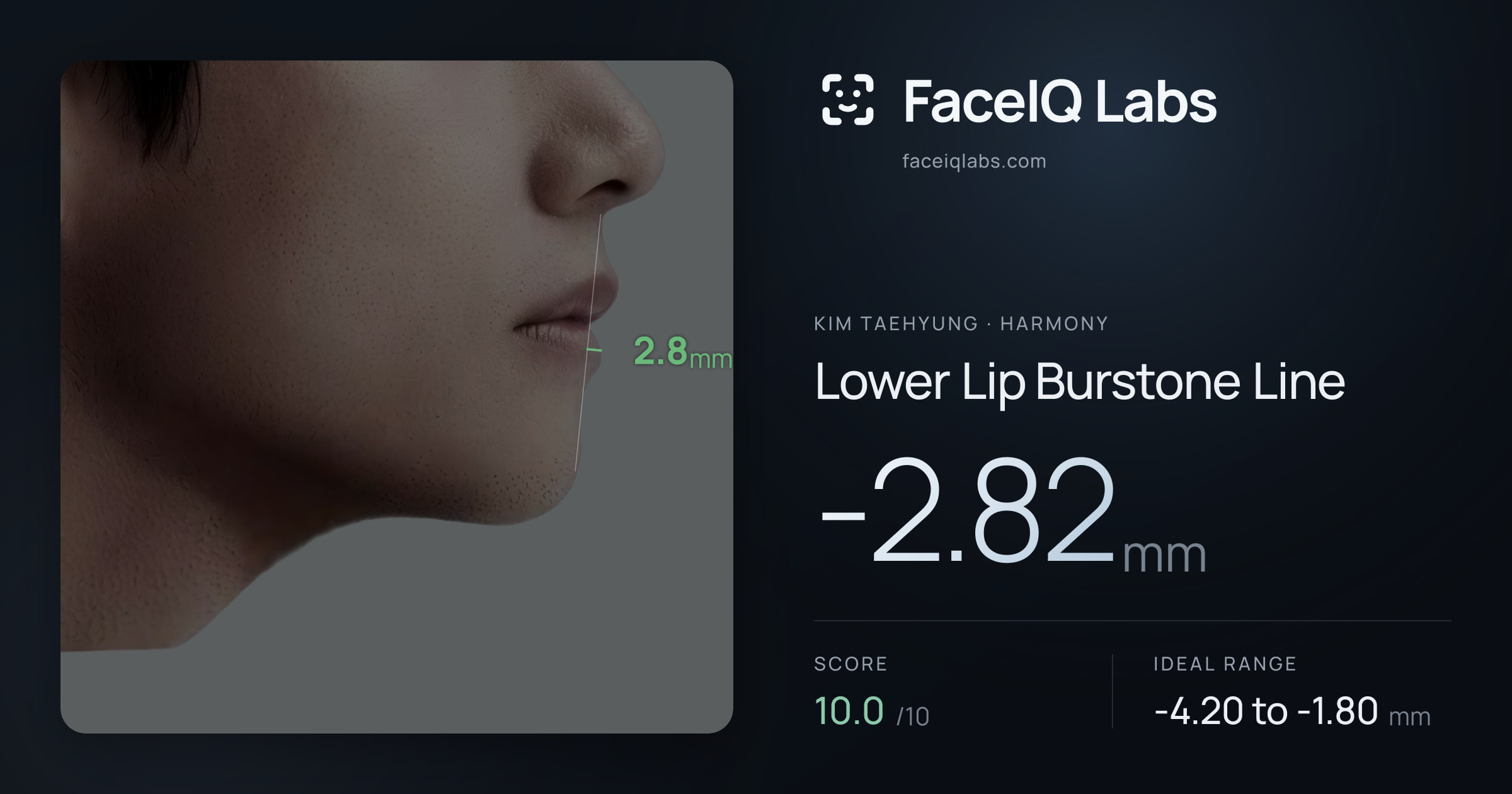Kim Taehyung Lower Lip Burstone Line: -2.82mm, drawn on the photo