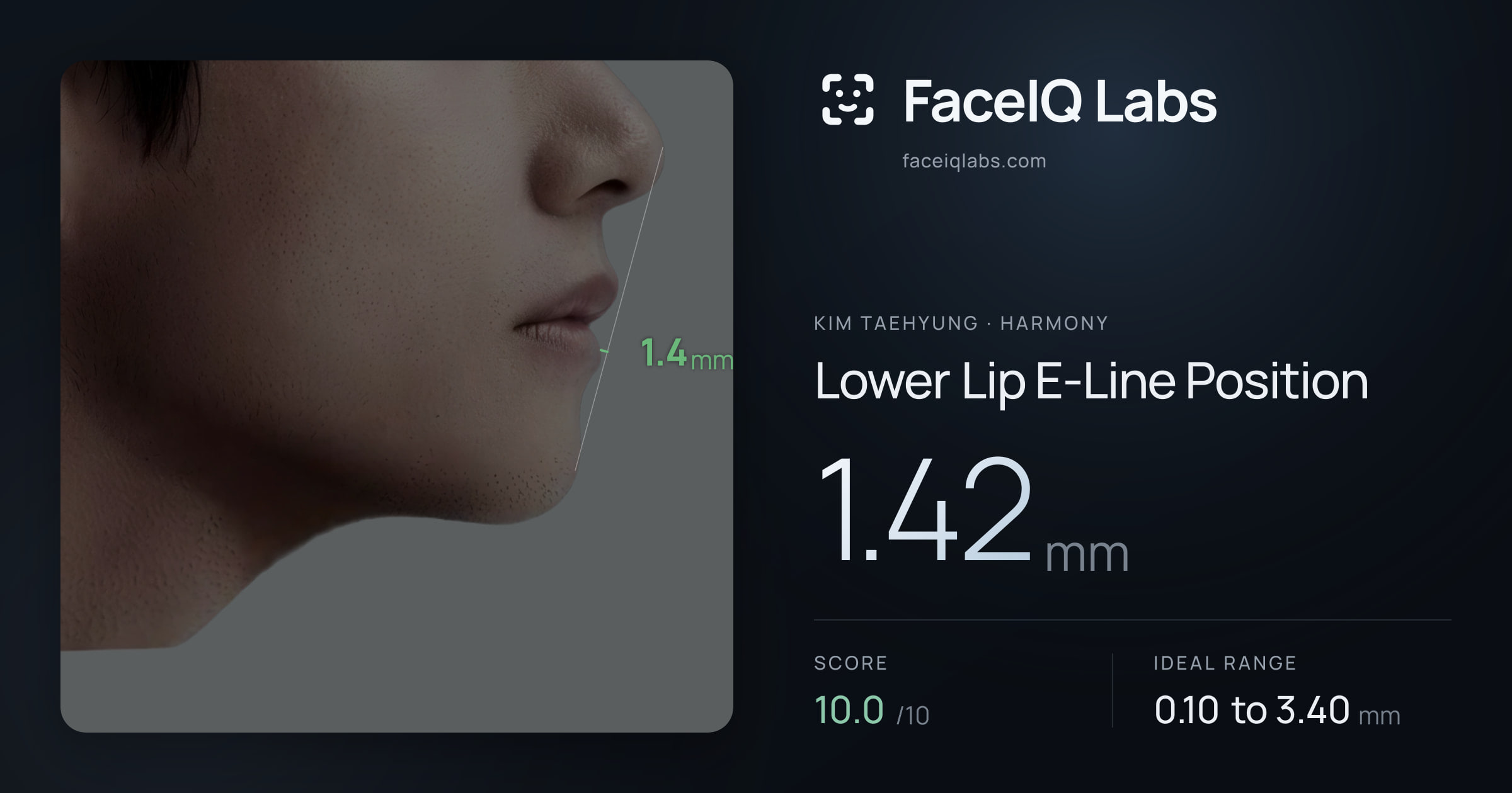 Kim Taehyung Lower Lip E-Line Position: 1.42mm, drawn on the photo