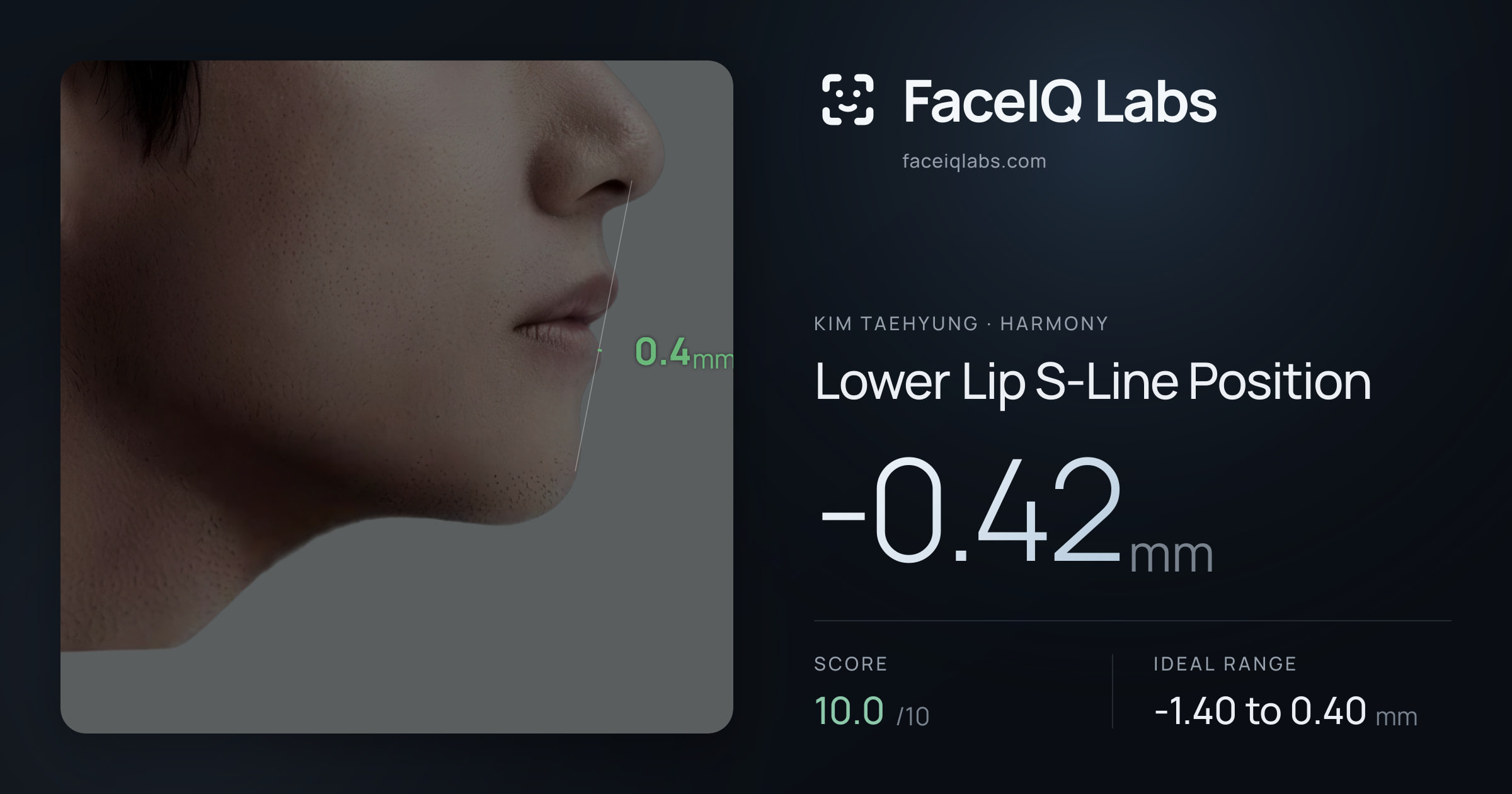 Kim Taehyung Lower Lip S-Line Position: -0.42mm, drawn on the photo