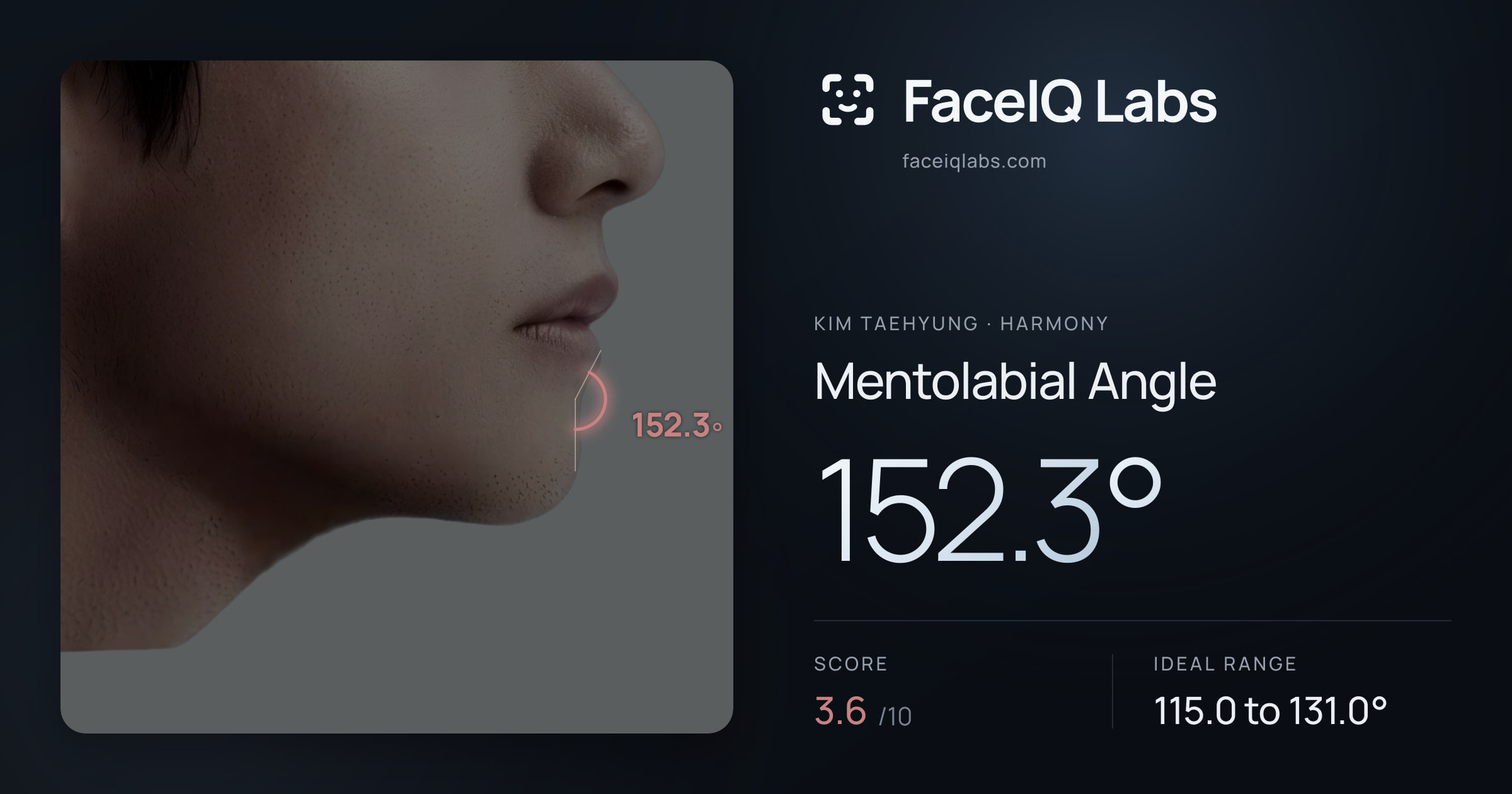 Kim Taehyung Mentolabial Angle: 152.3°, drawn on the photo