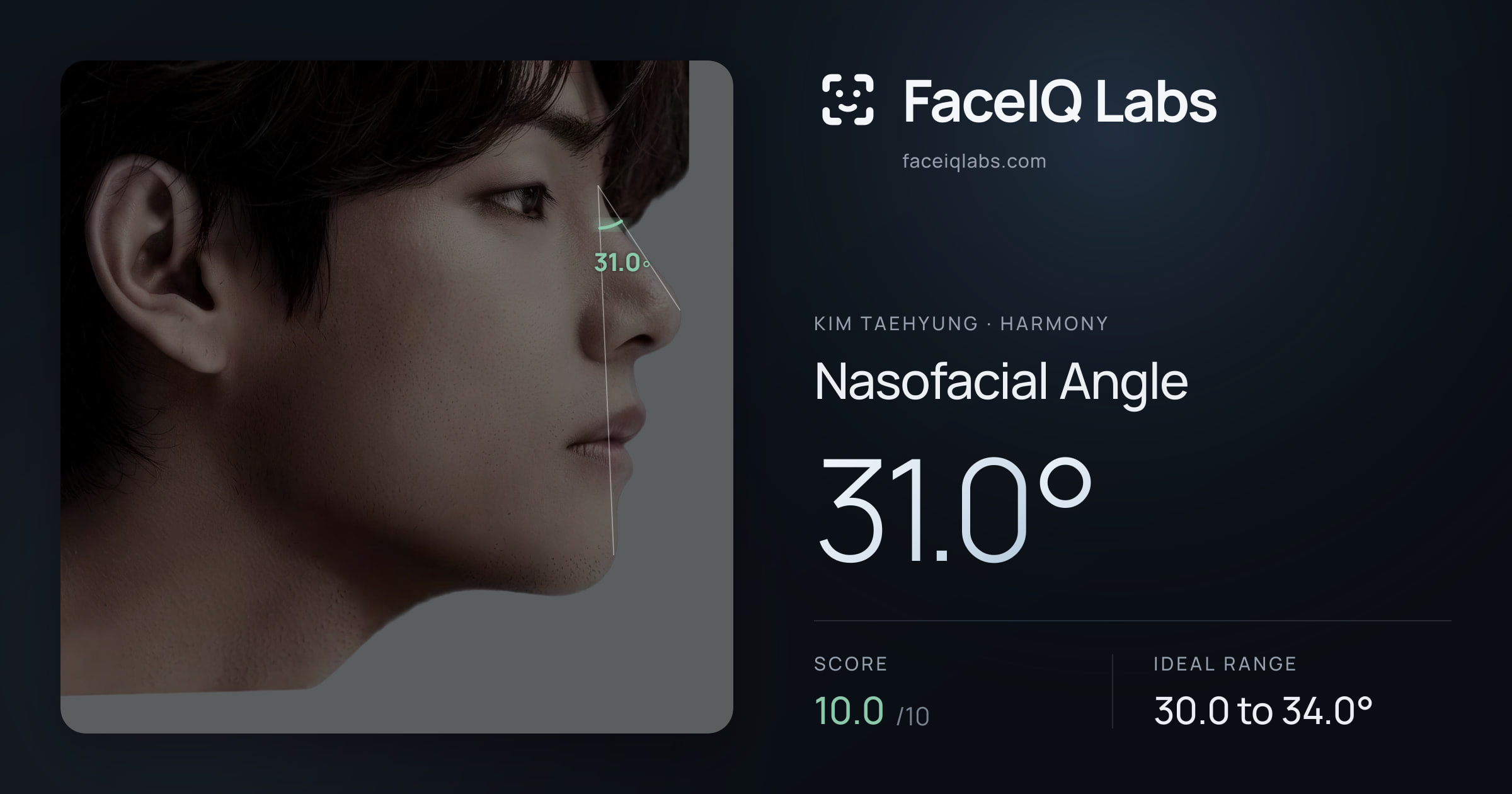 Kim Taehyung Nasofacial Angle: 31.0°, drawn on the photo
