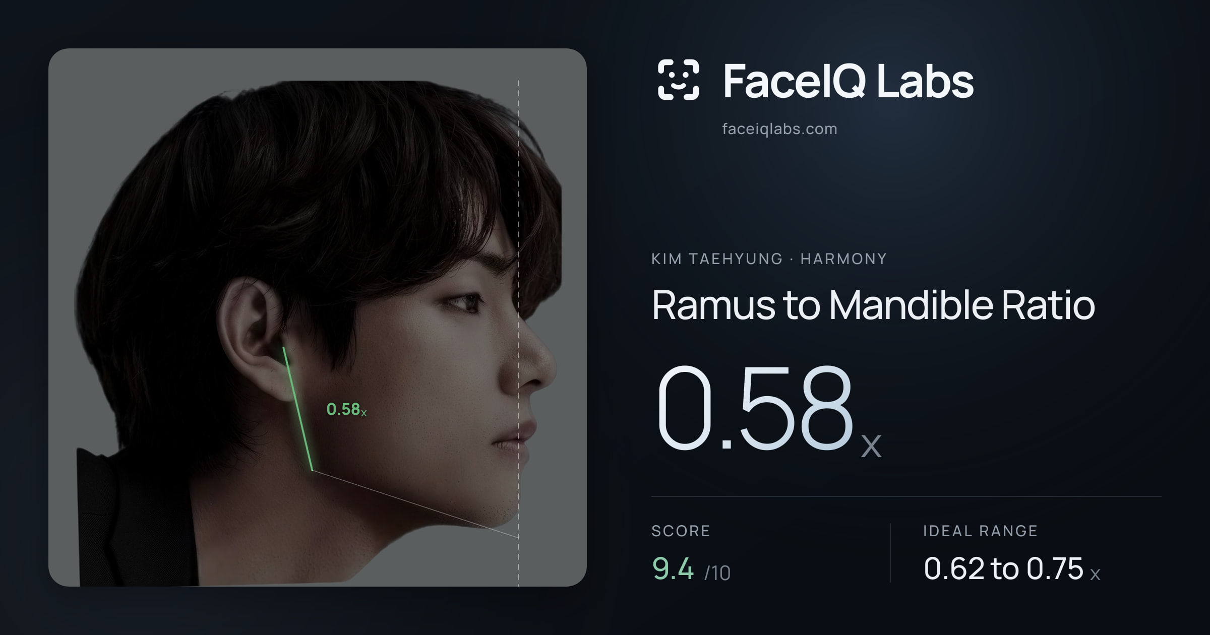 Kim Taehyung Ramus to Mandible Ratio: 0.58x, drawn on the photo