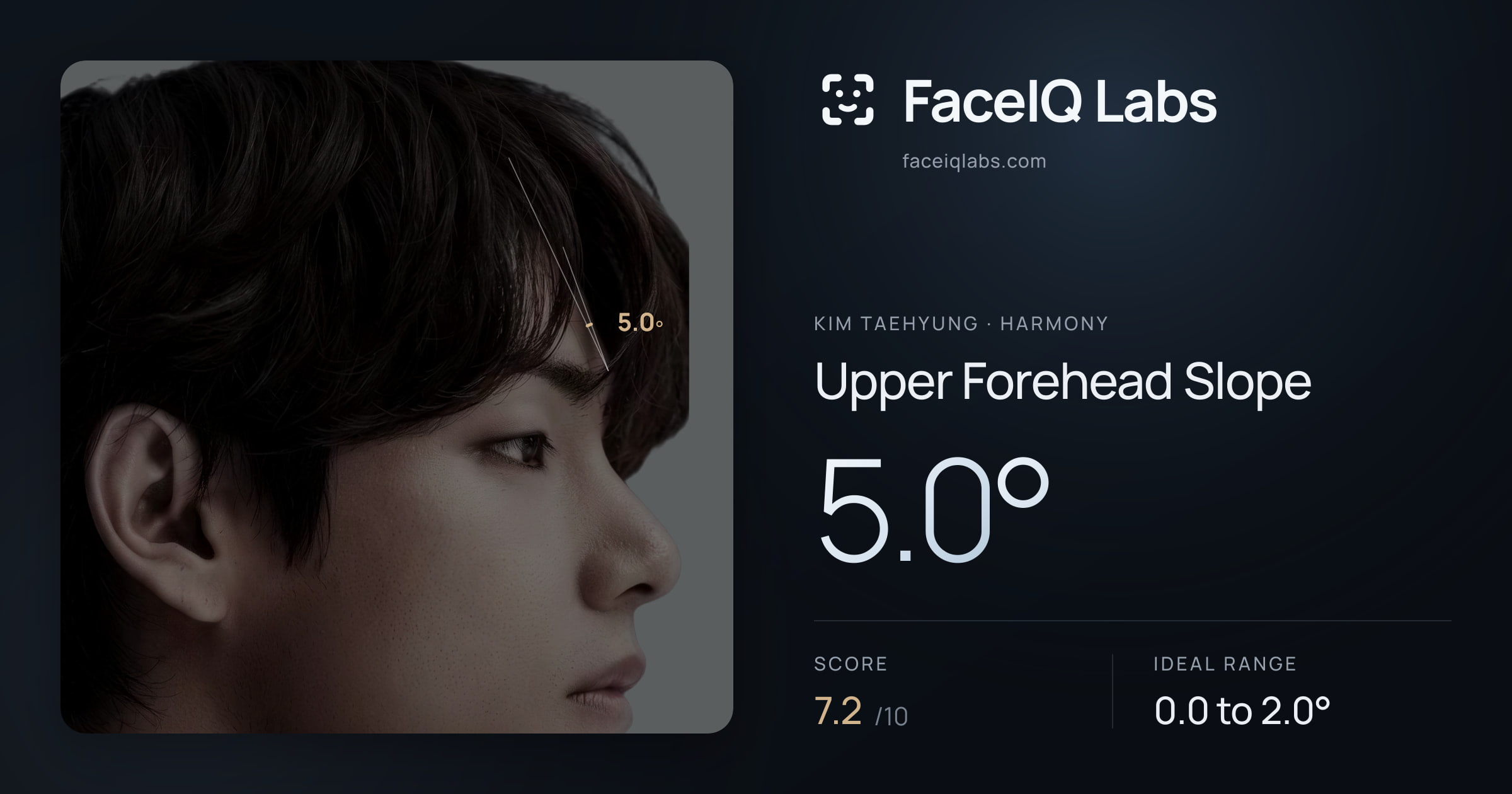 Kim Taehyung Upper Forehead Slope: 5.0°, drawn on the photo