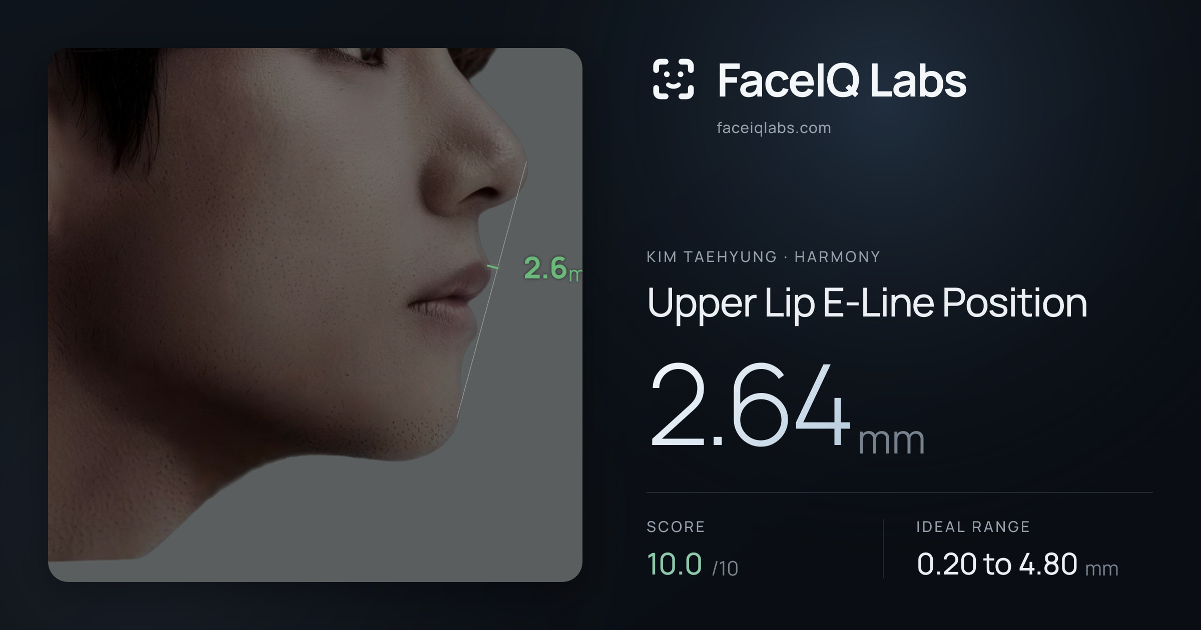 Kim Taehyung Upper Lip E-Line Position: 2.64mm, drawn on the photo