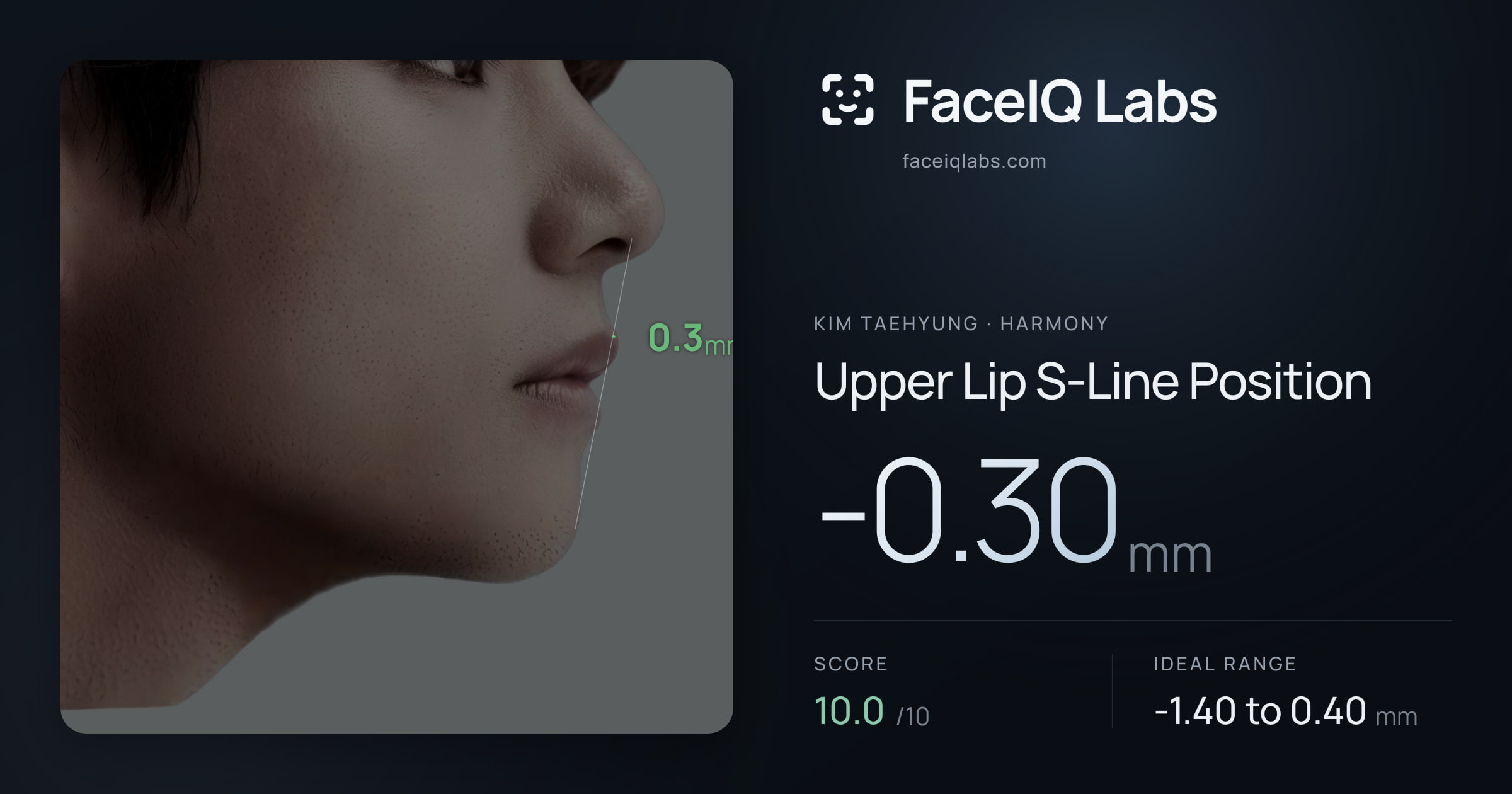 Kim Taehyung Upper Lip S-Line Position: -0.30mm, drawn on the photo