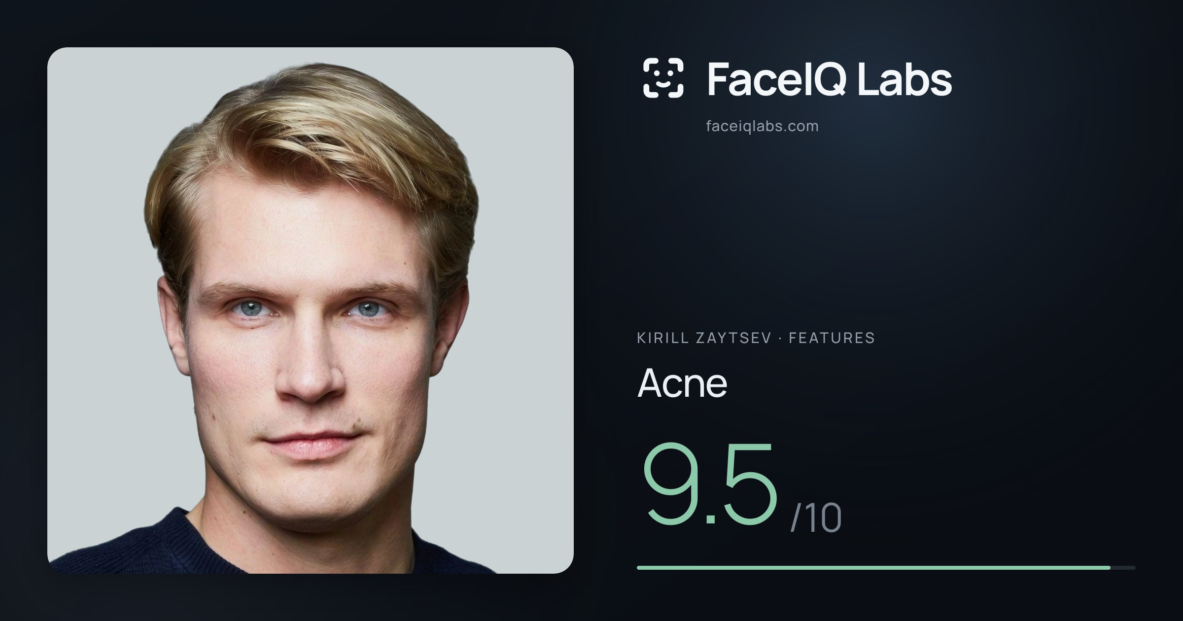 Kirill Zaytsev Acne: 9.5/10, drawn on the photo