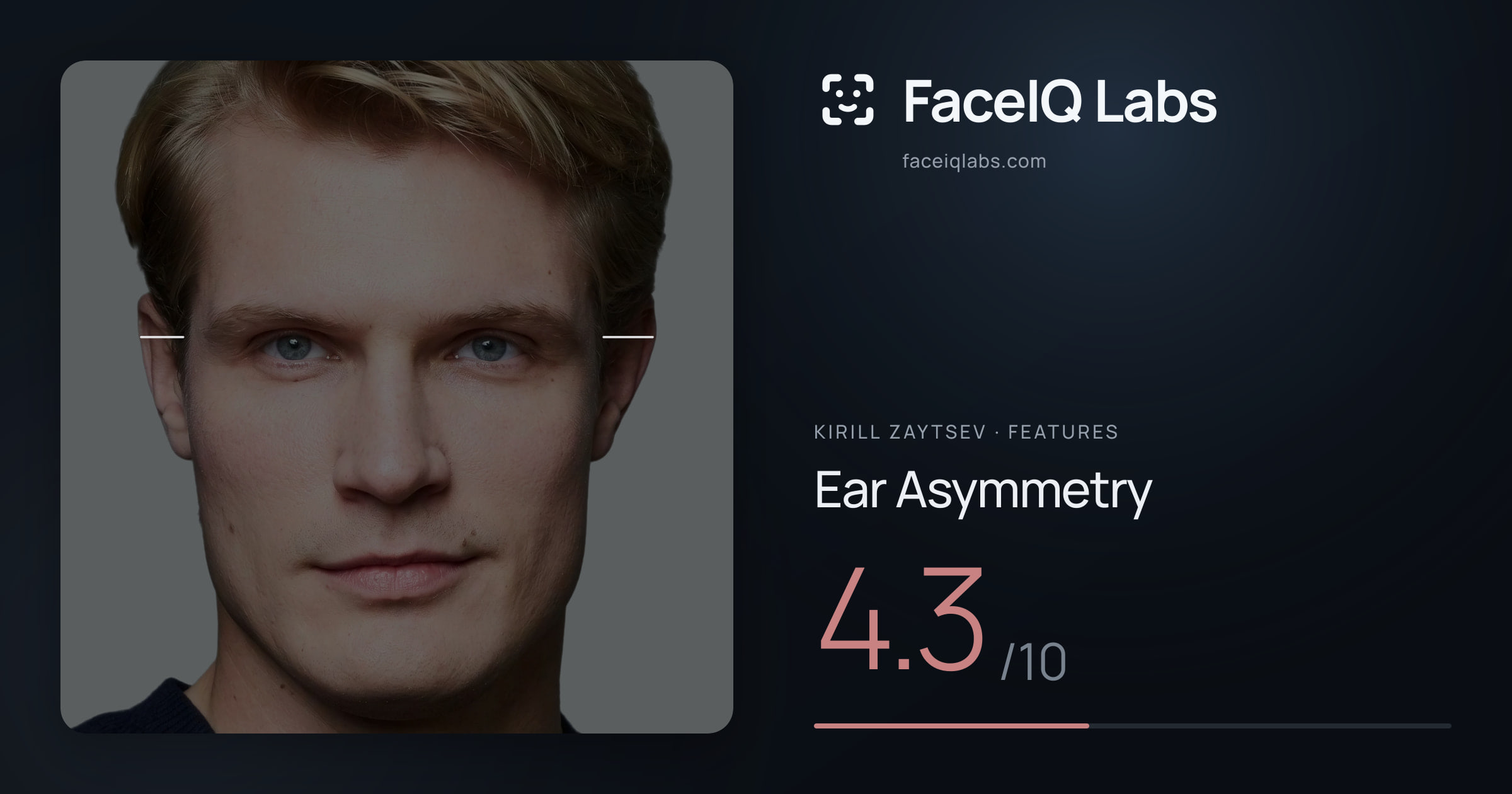 Kirill Zaytsev Ear Asymmetry: 4.3/10, drawn on the photo