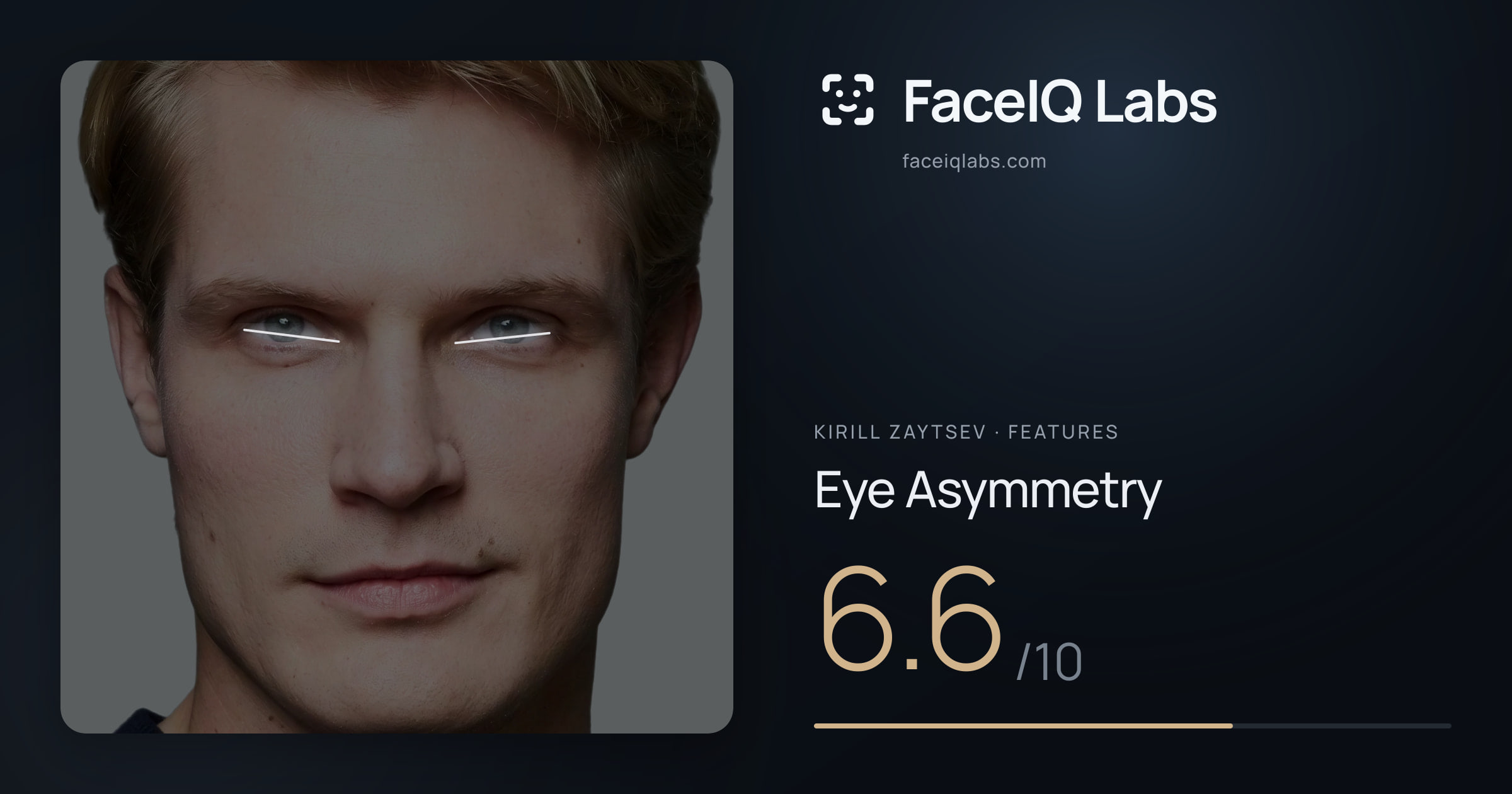 Kirill Zaytsev Eye Asymmetry: 6.6/10, drawn on the photo