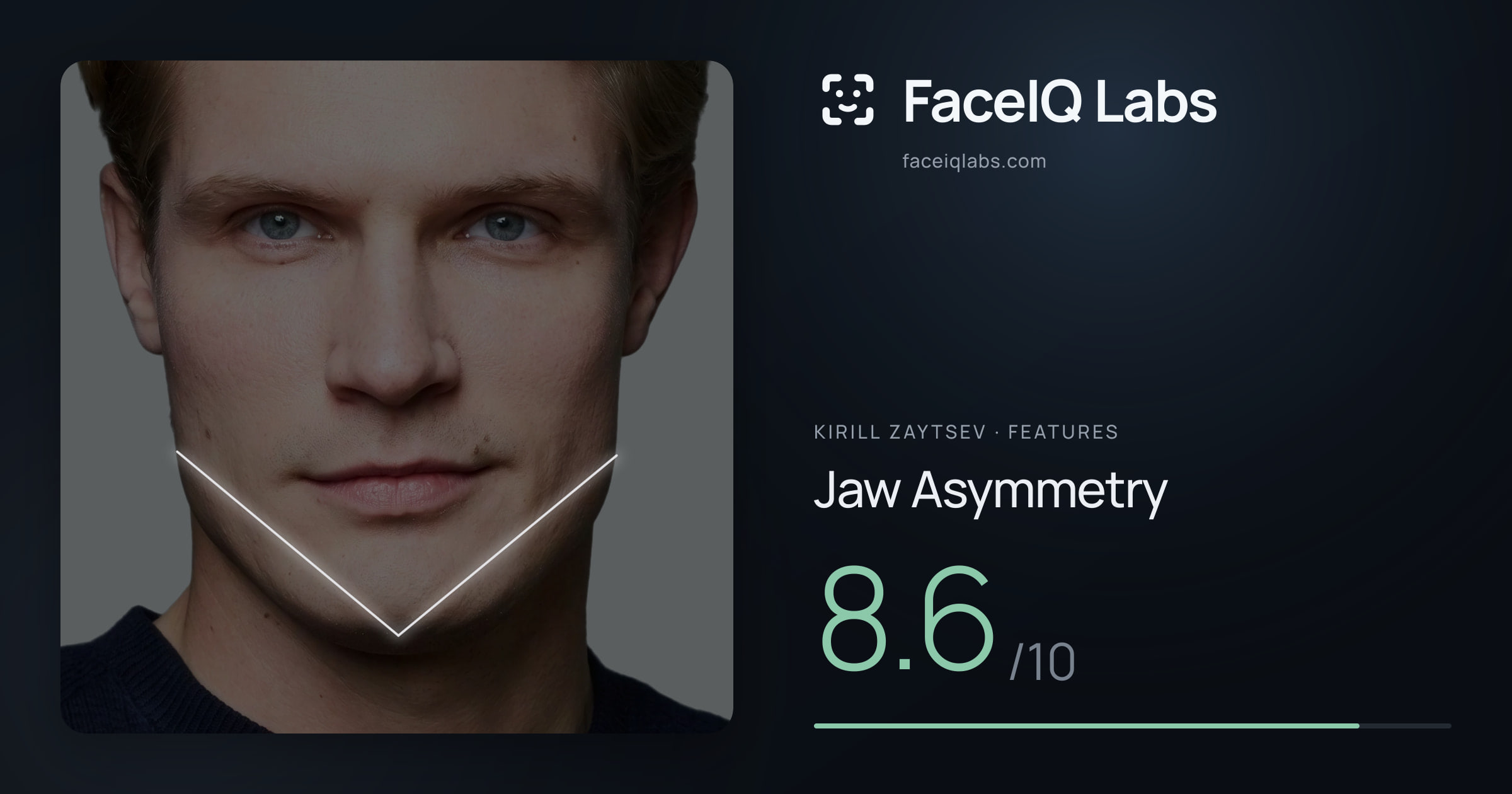 Kirill Zaytsev Jaw Asymmetry: 8.6/10, drawn on the photo